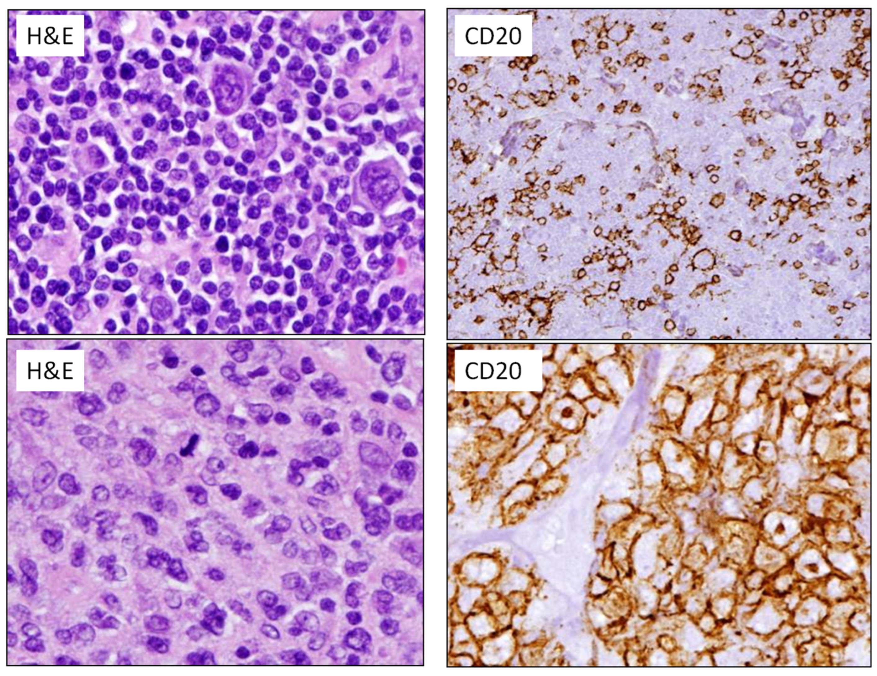 Hemato 05 00013 g006