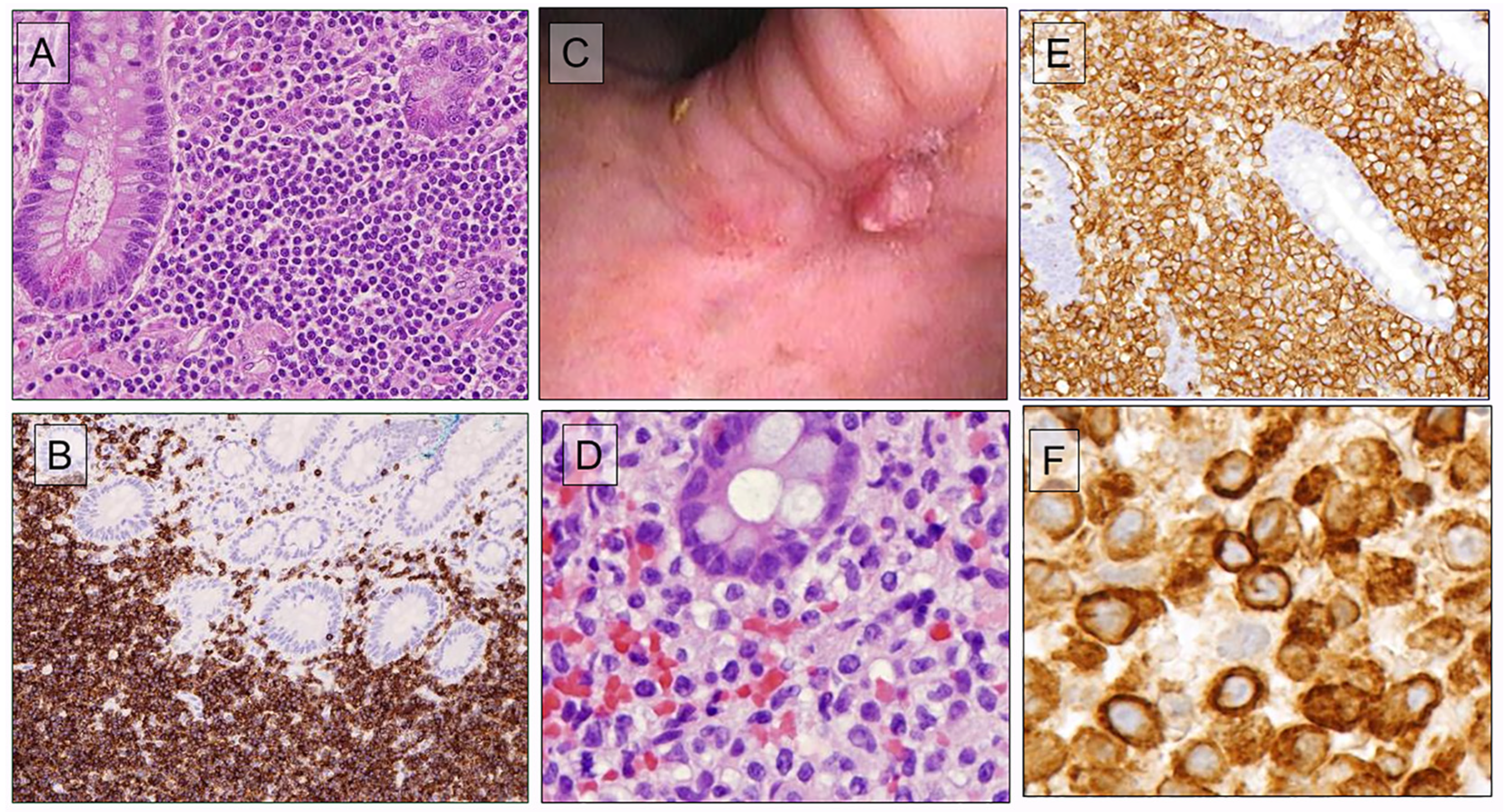 Hemato 05 00013 g007