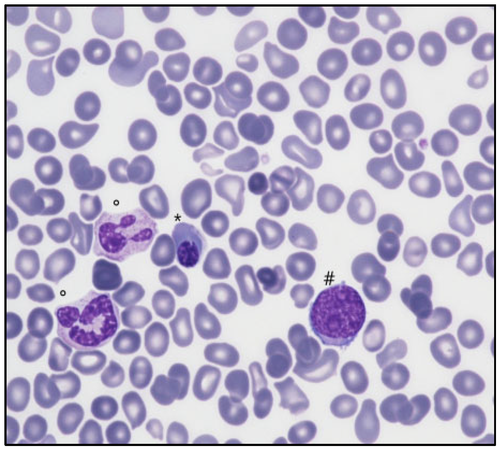 Hemato 05 00021 g001