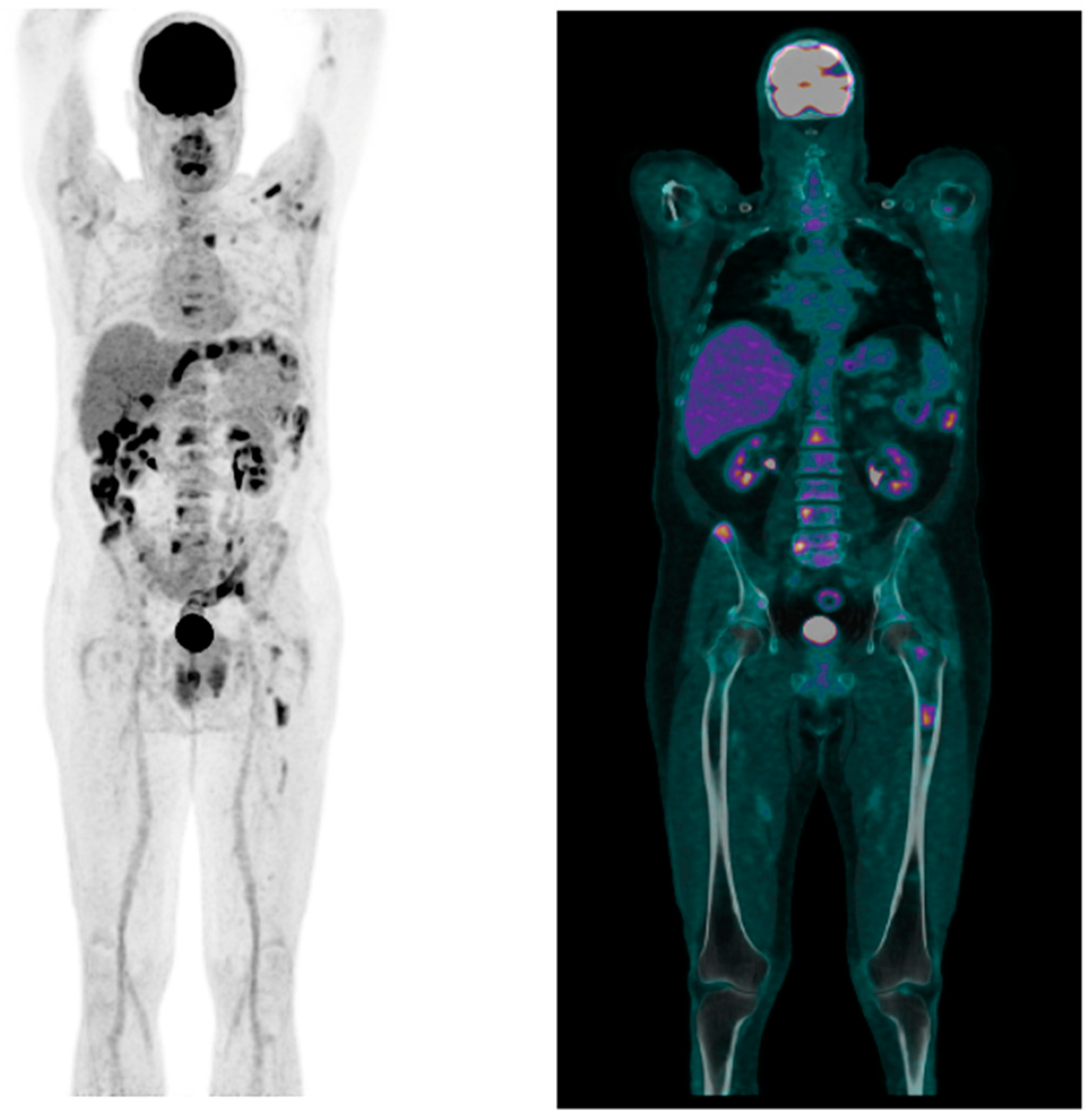 Hemato 05 00028 g002