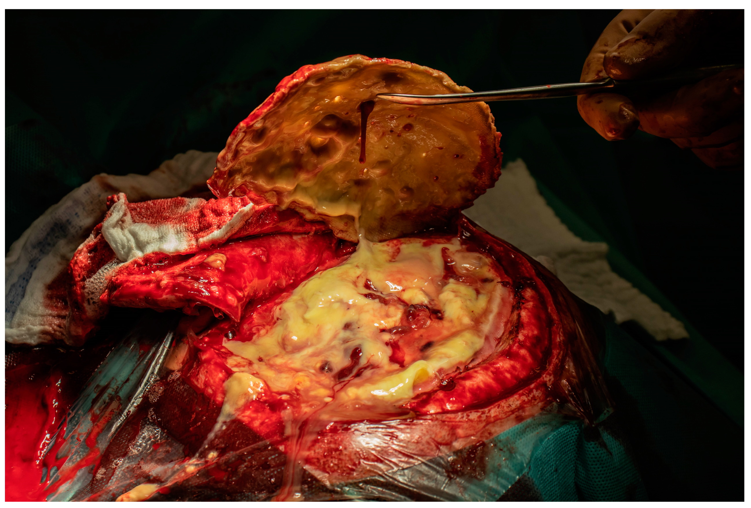 Hemato 06 00011 g001