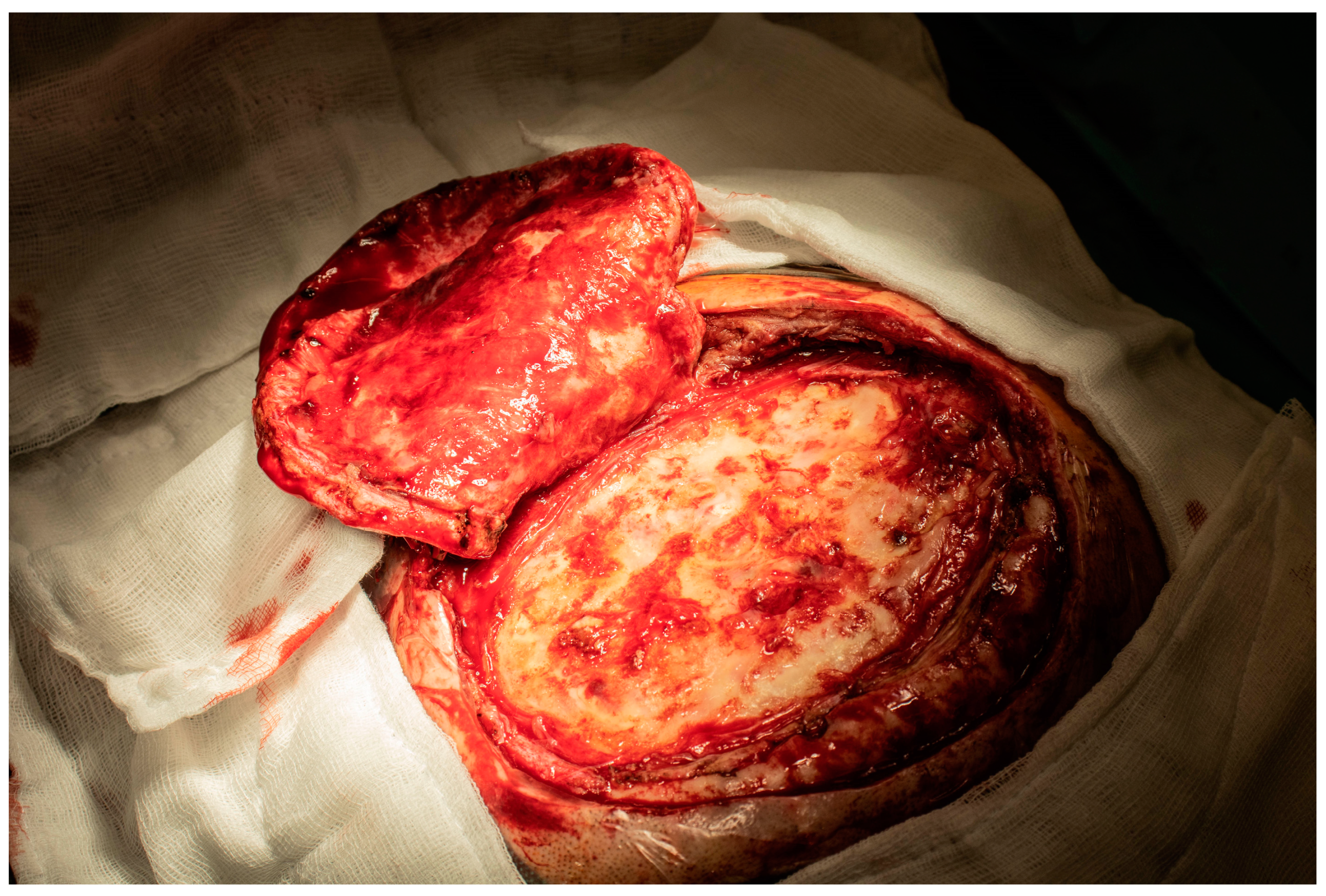 Hemato 06 00011 g002