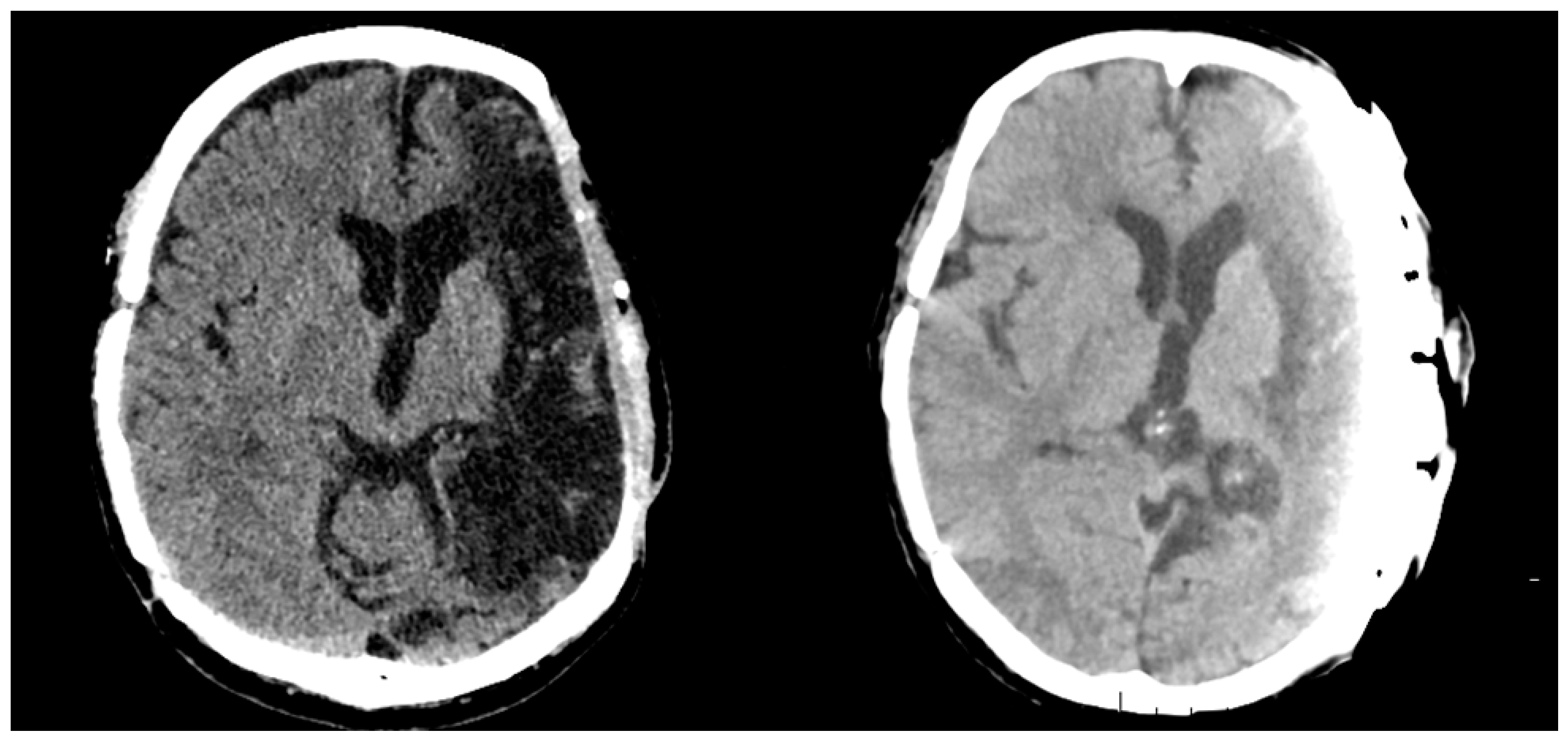 Hemato 06 00011 g004