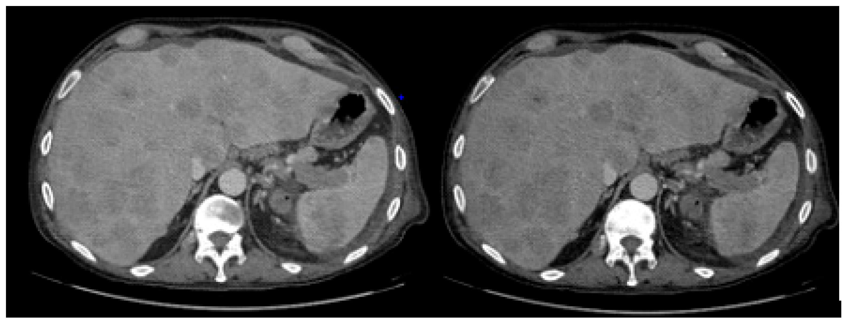 Hemato 06 00018 g001