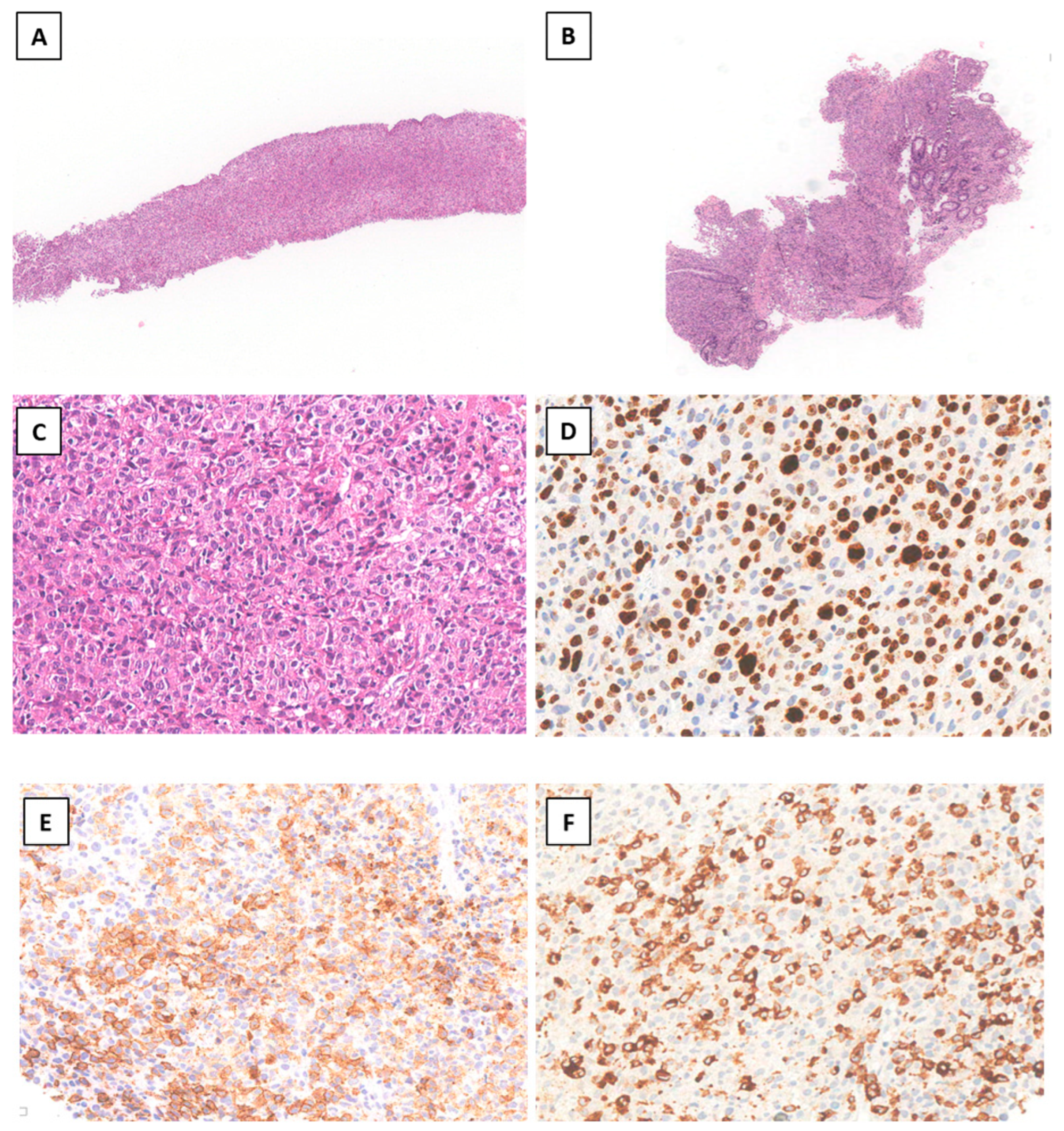 Hemato 06 00018 g002