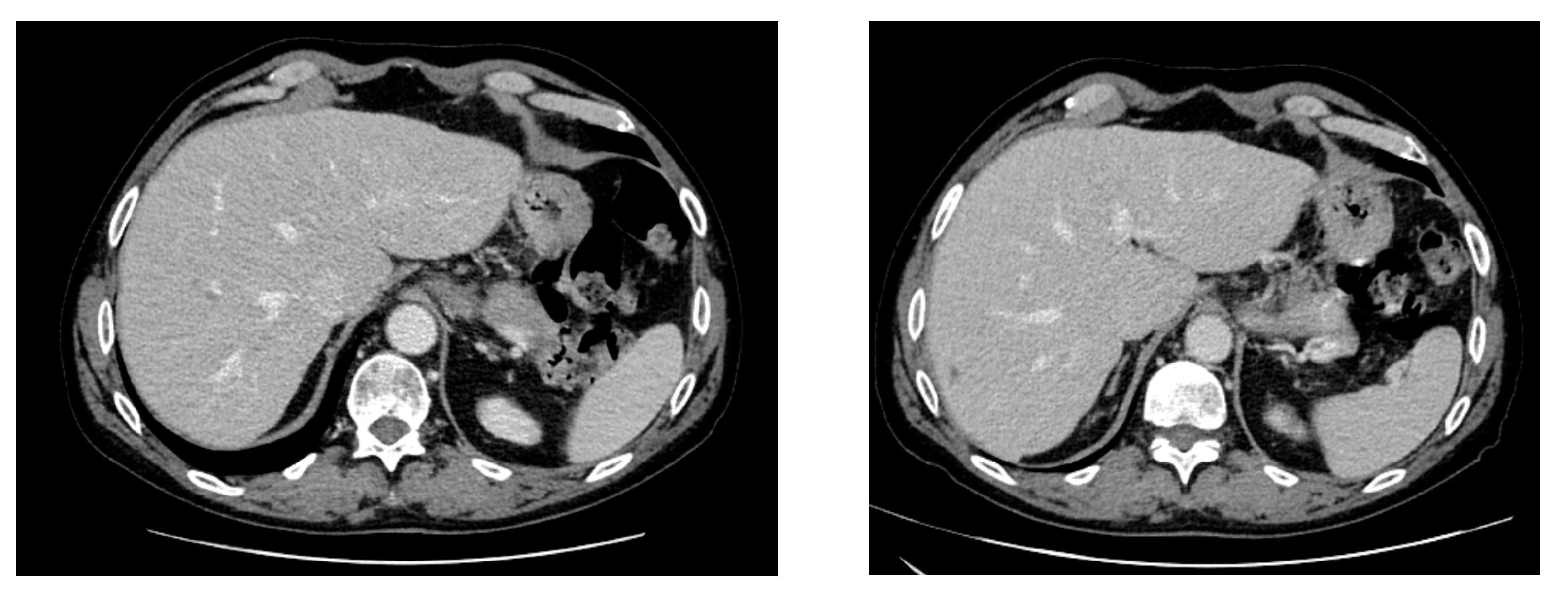 Hemato 06 00018 g003