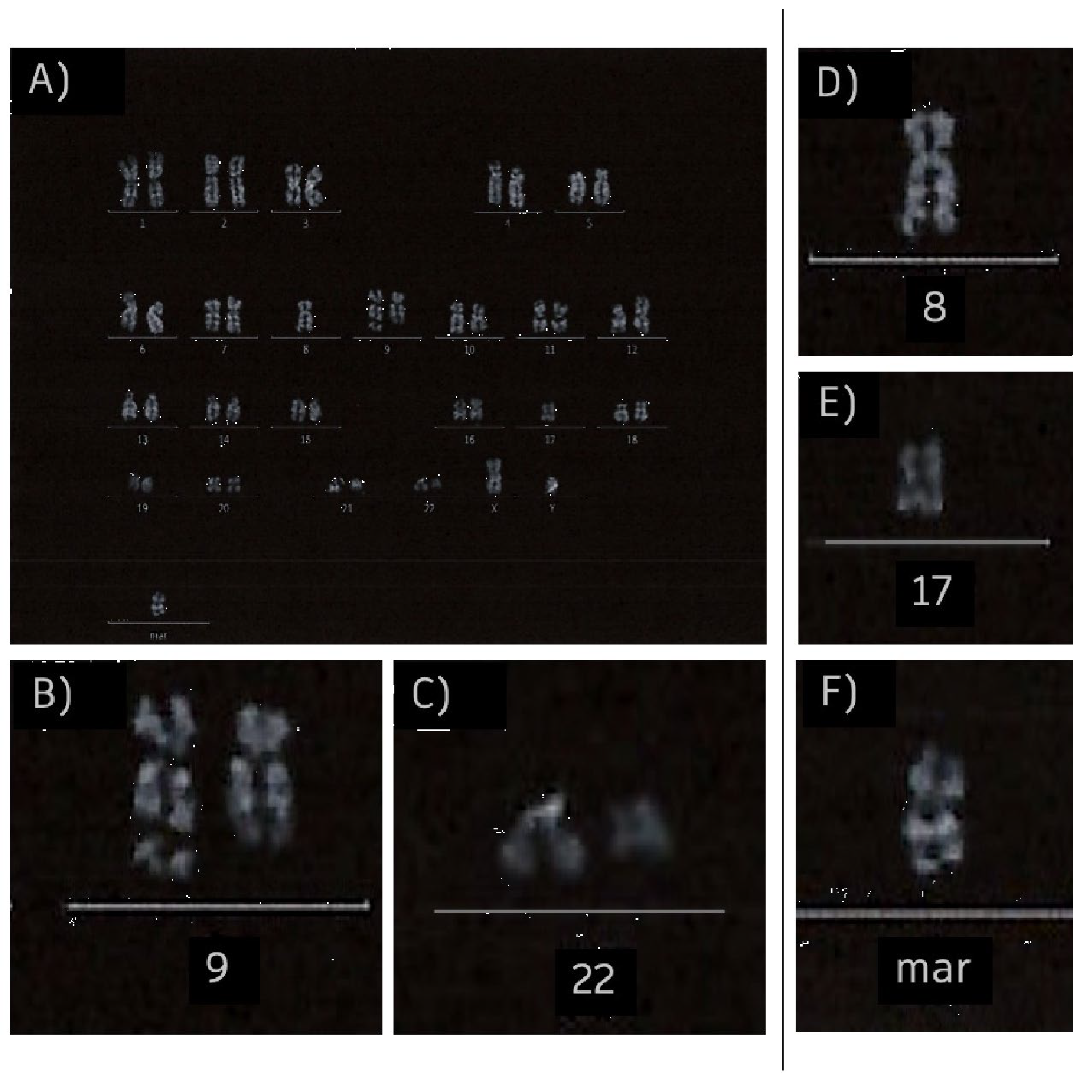 Hemato 06 00027 g004 Hemato 06 00027 g004