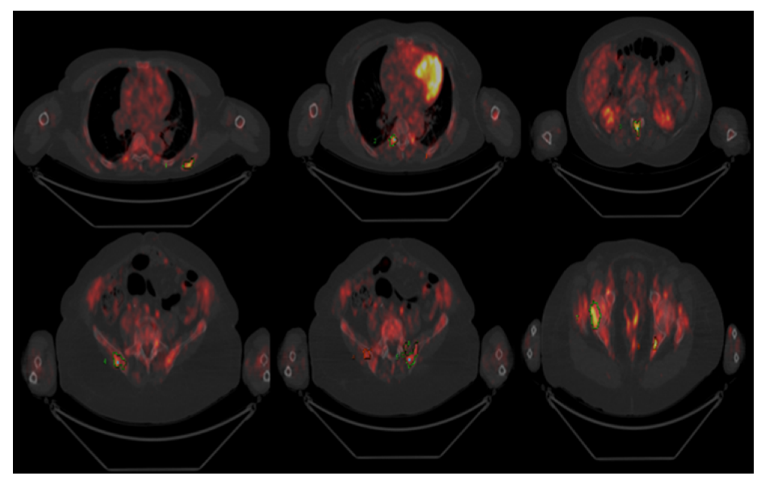 Hematolrep 14 00004 g001