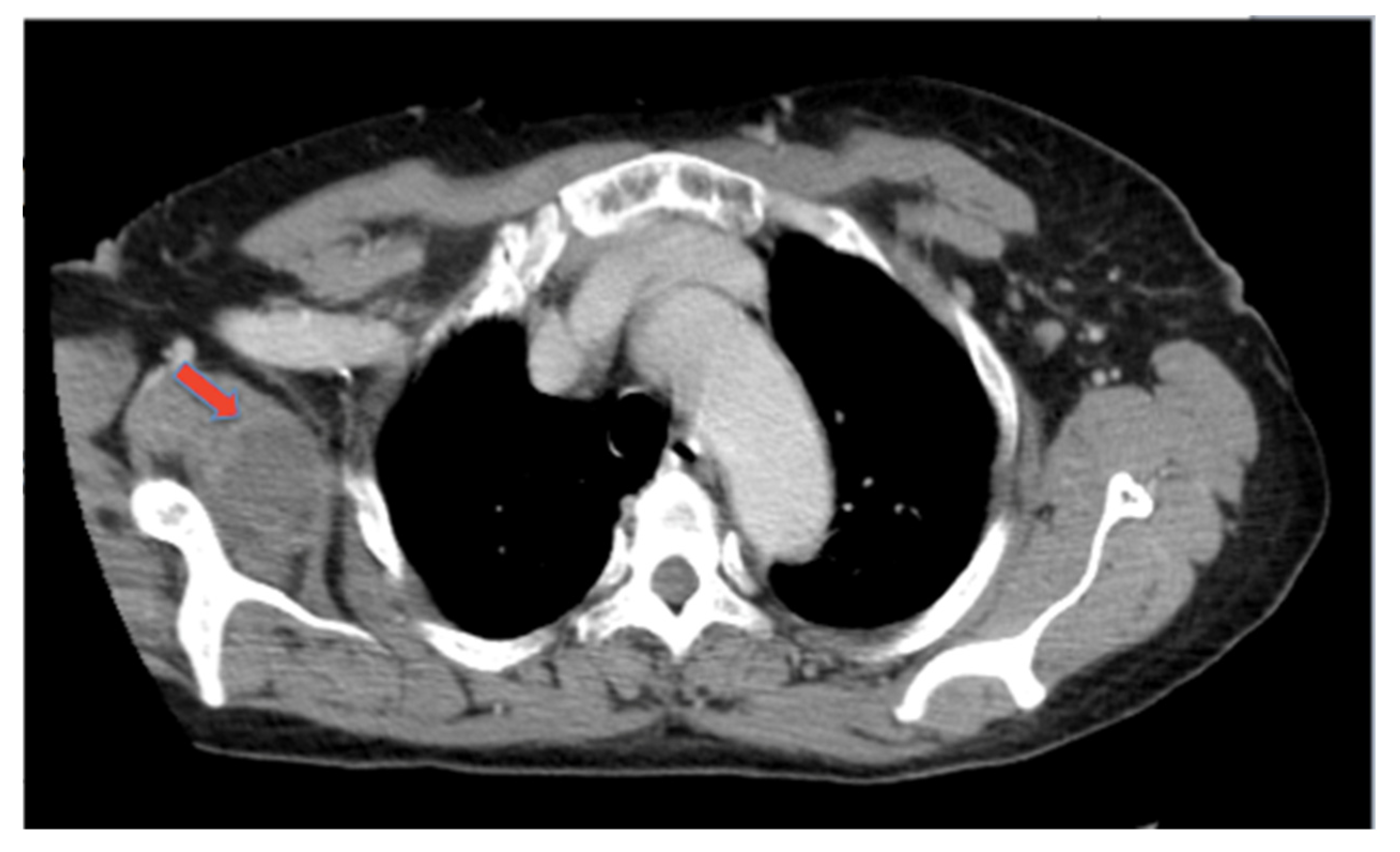 Hematolrep 14 00004 g002