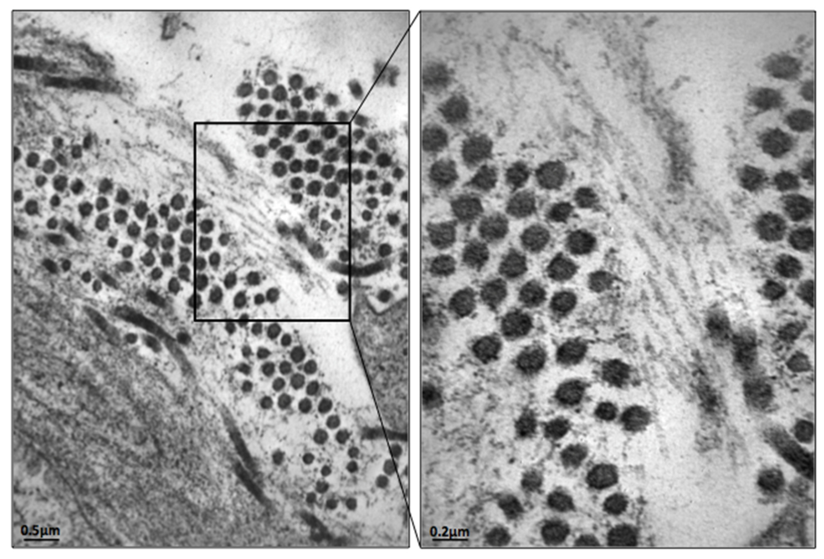 Hematolrep 14 00004 g004