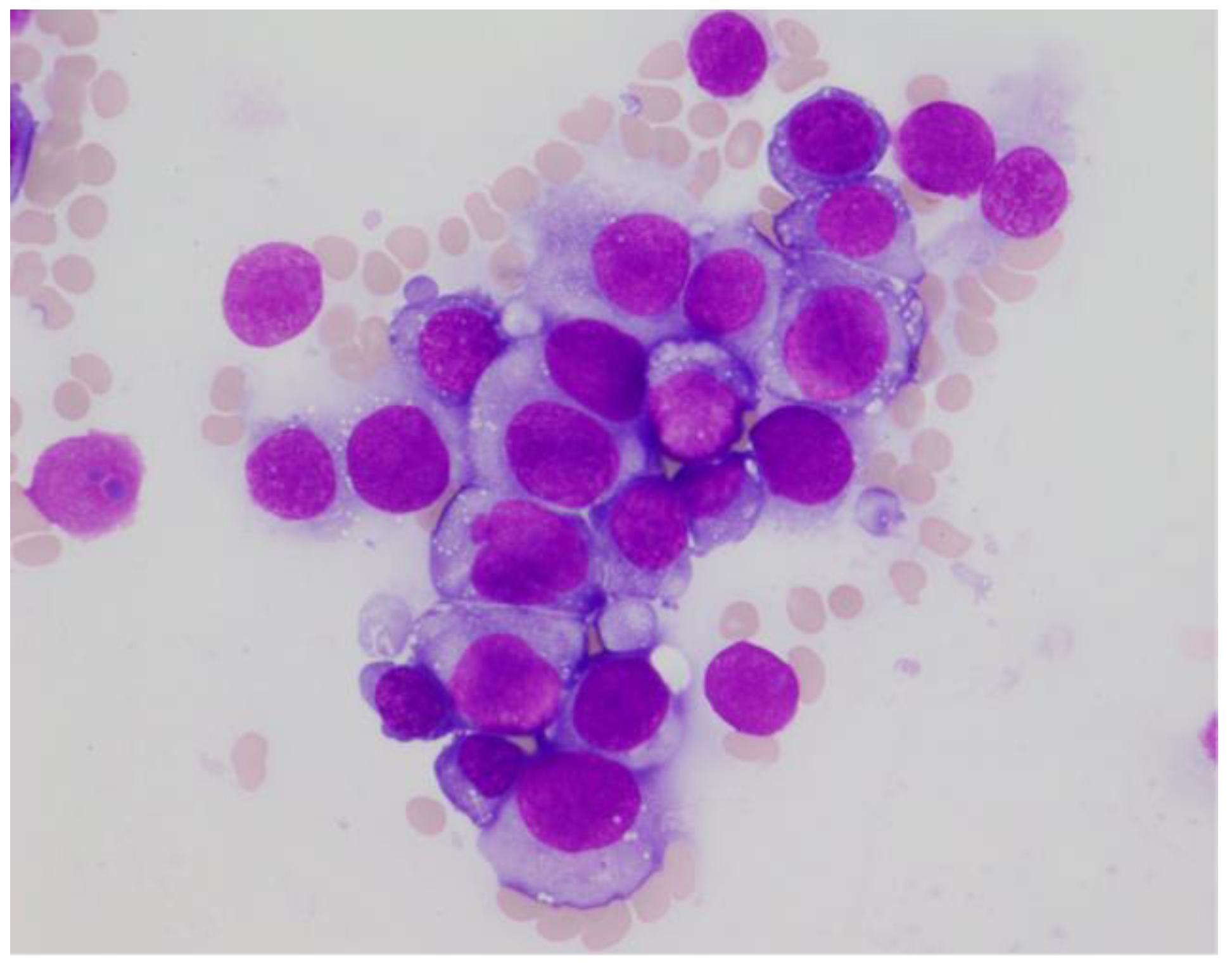 Hematolrep 14 00007 g001