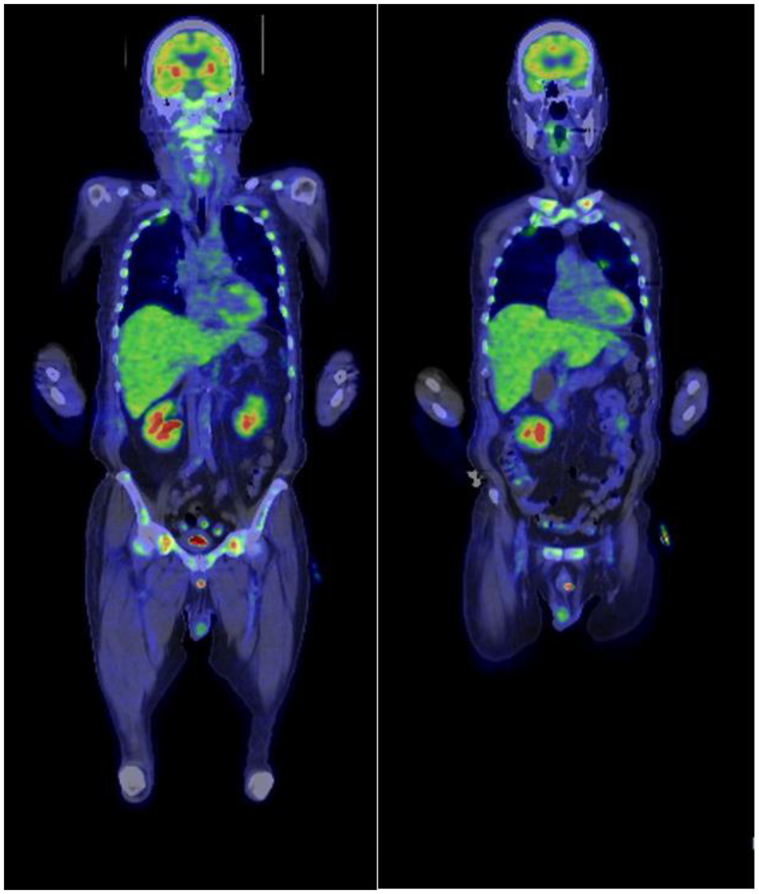 Hematolrep 14 00007 g002