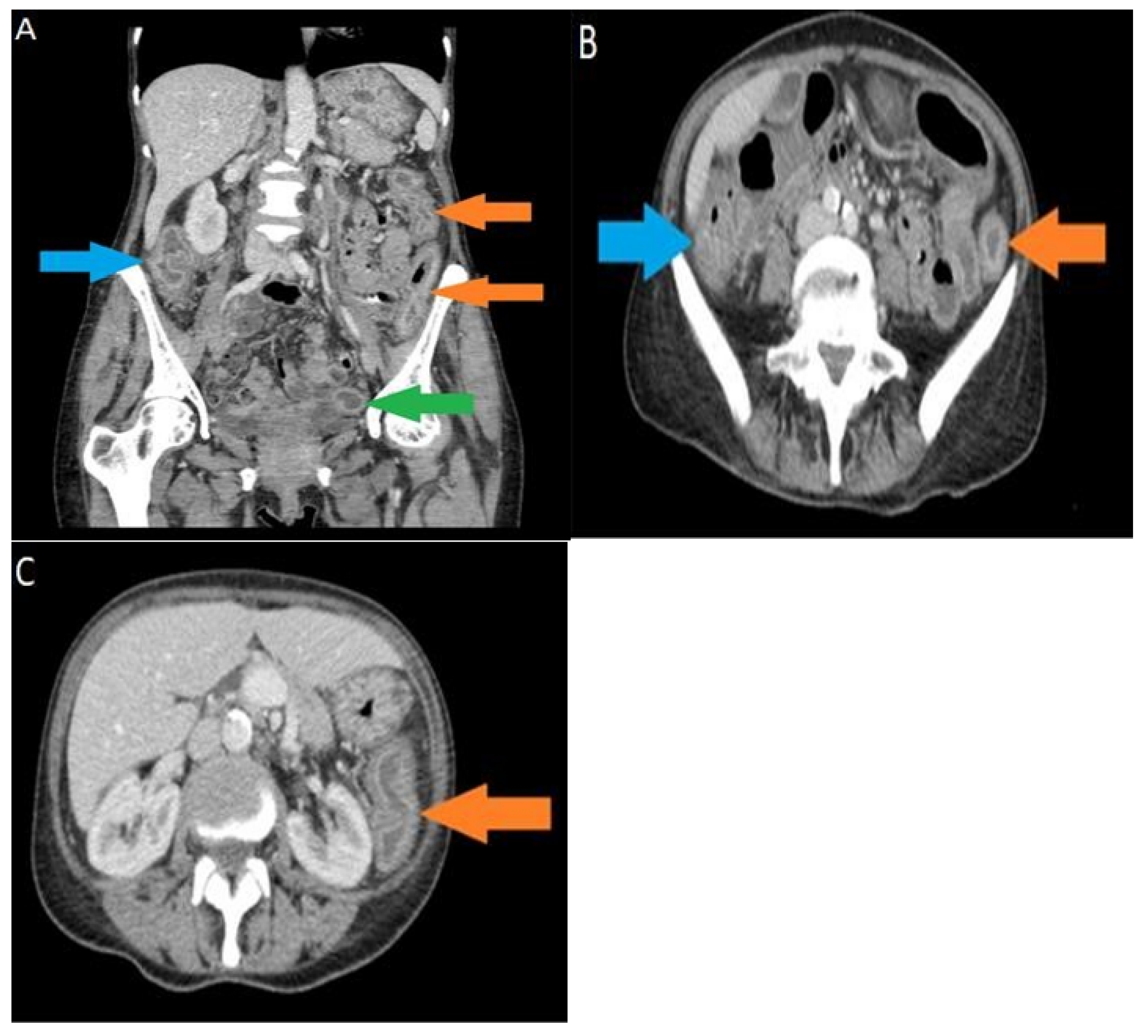 Hematolrep 14 00029 g001 Hematolrep 14 00029 g001