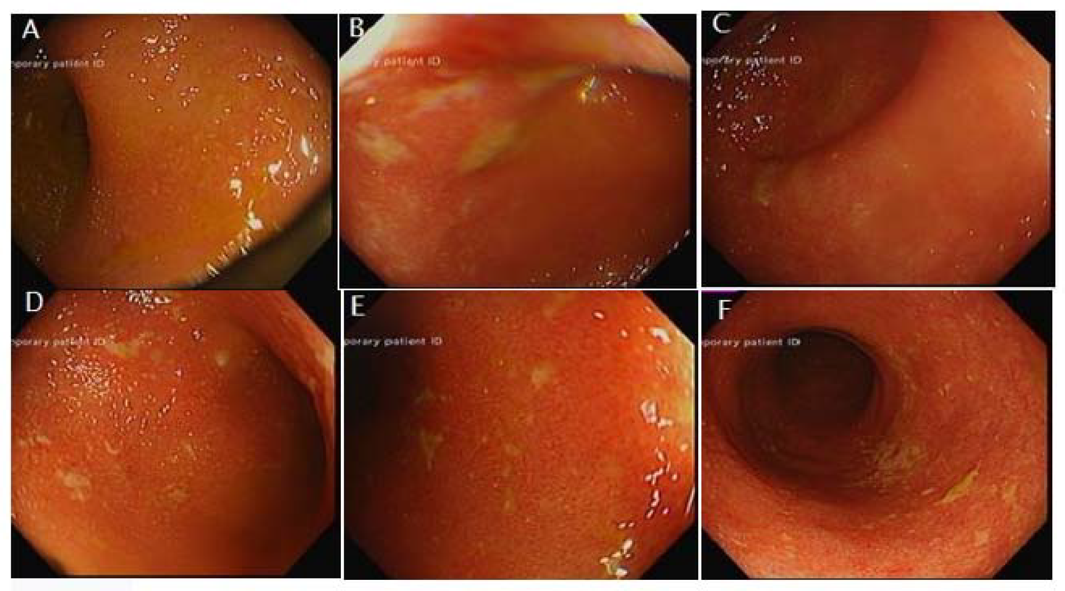 Hematolrep 14 00029 g002 Hematolrep 14 00029 g002