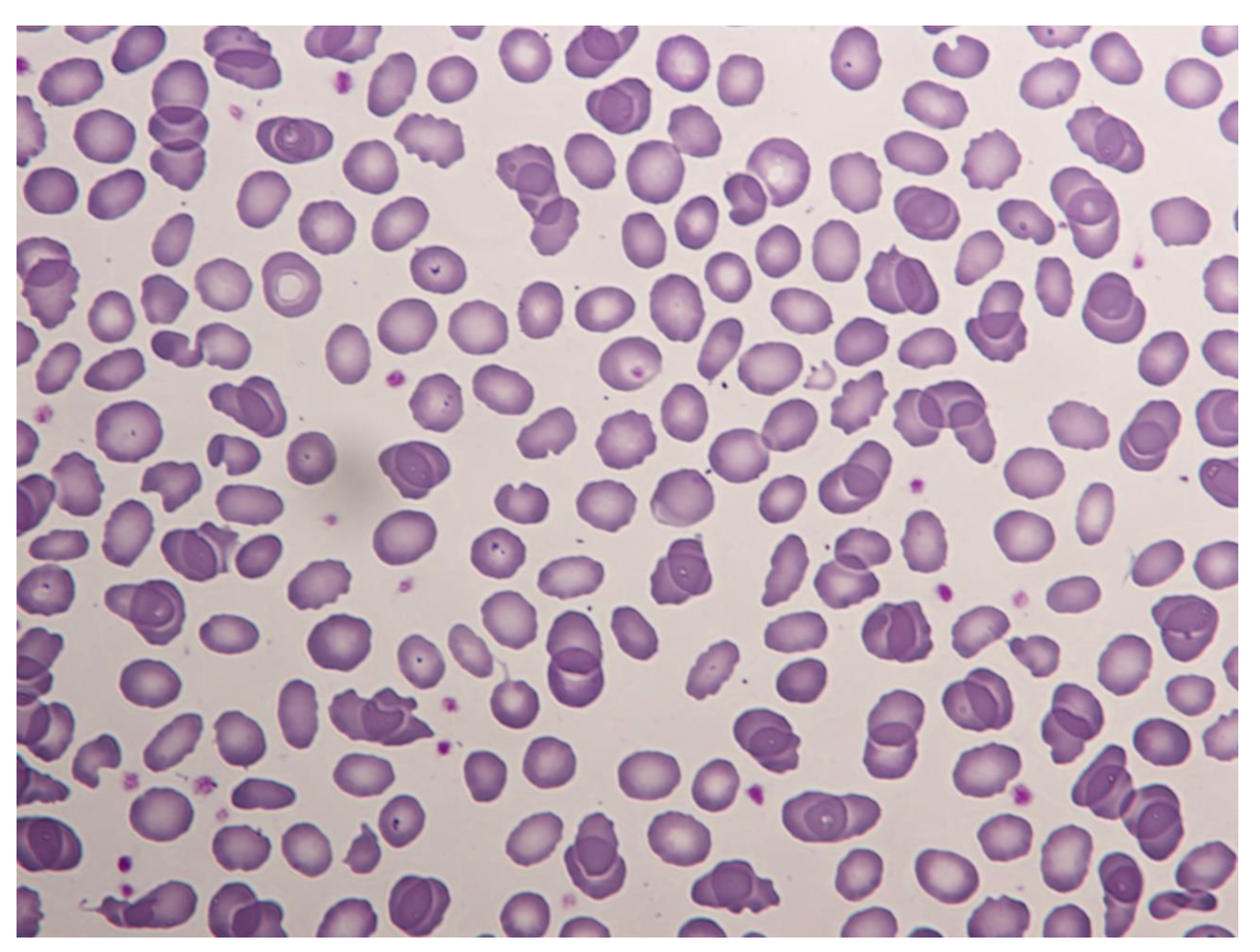 Hematolrep 14 00043 g001