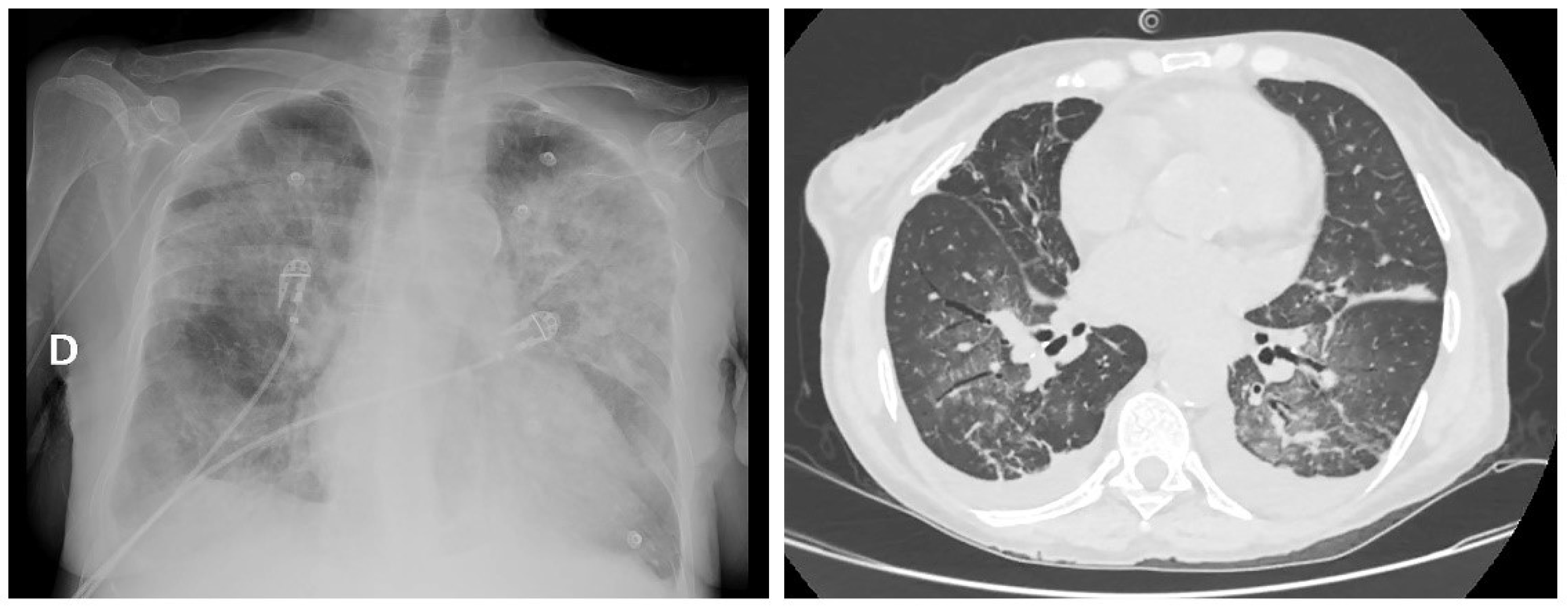 Hematolrep 14 00045 g003 Hematolrep 14 00045 g003