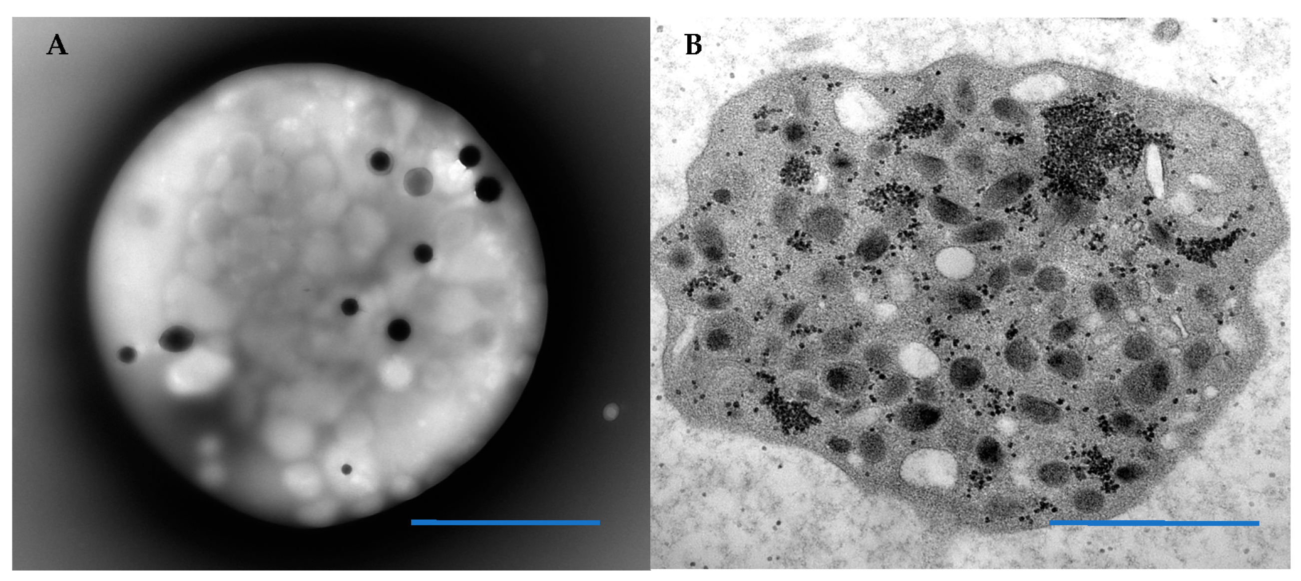 Hematolrep 14 00049 g001 Hematolrep 14 00049 g001