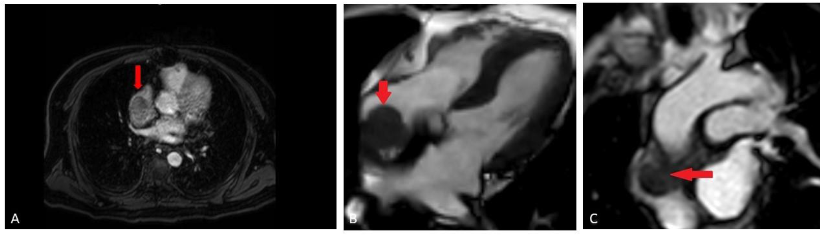Hematolrep 15 00007 g001 Hematolrep 15 00007 g001