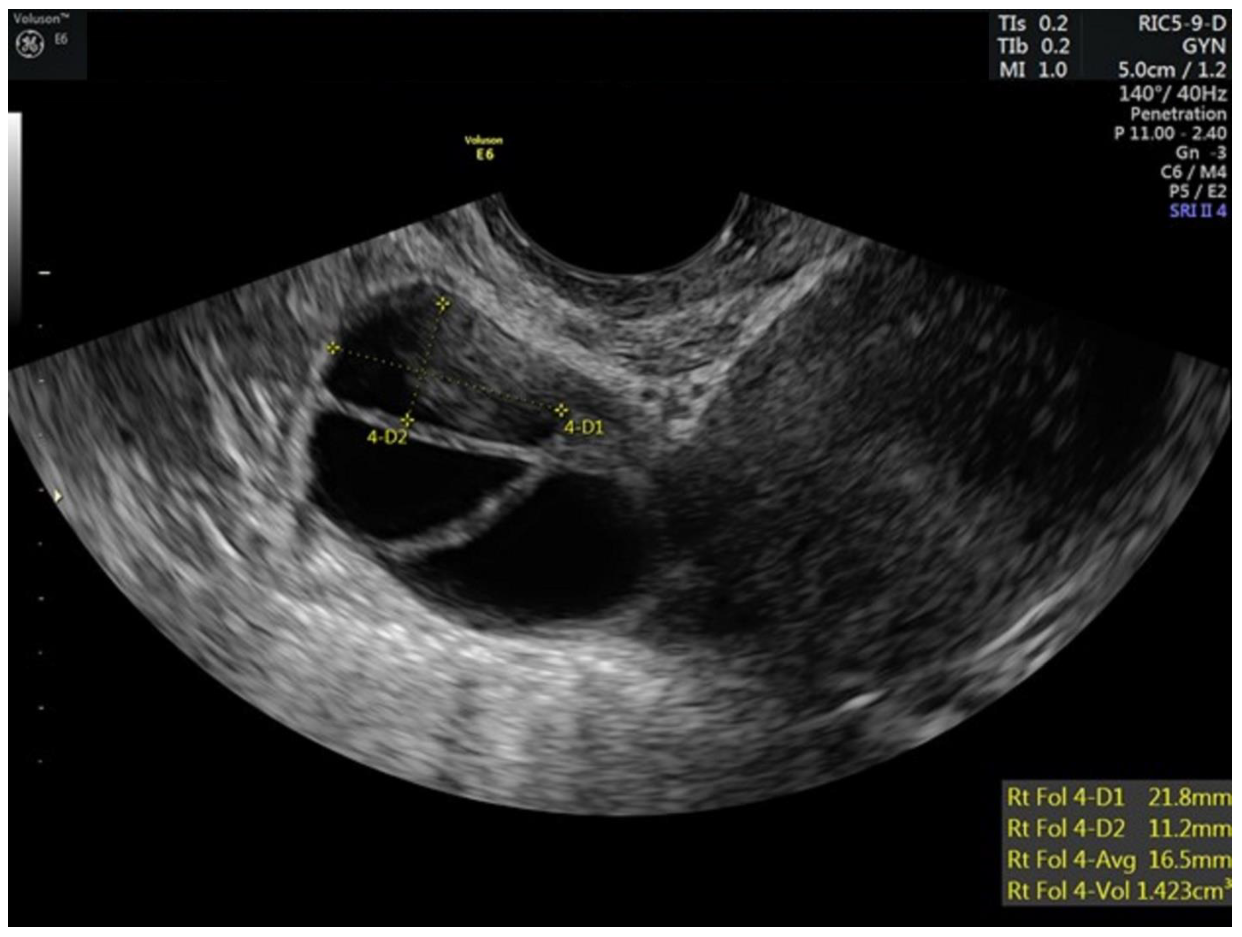 Hematolrep 15 00011 g001 Hematolrep 15 00011 g001