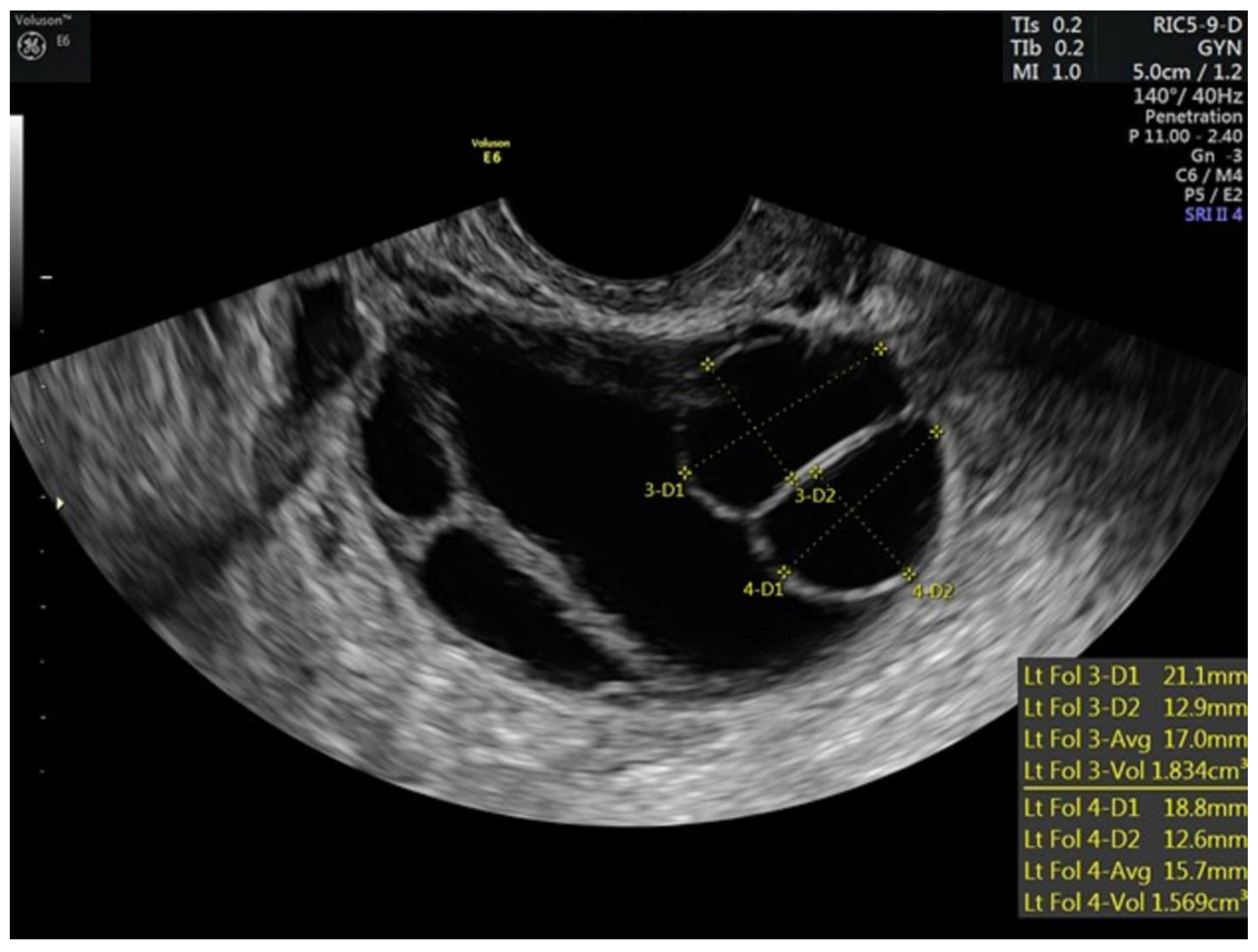 Hematolrep 15 00011 g002 Hematolrep 15 00011 g002