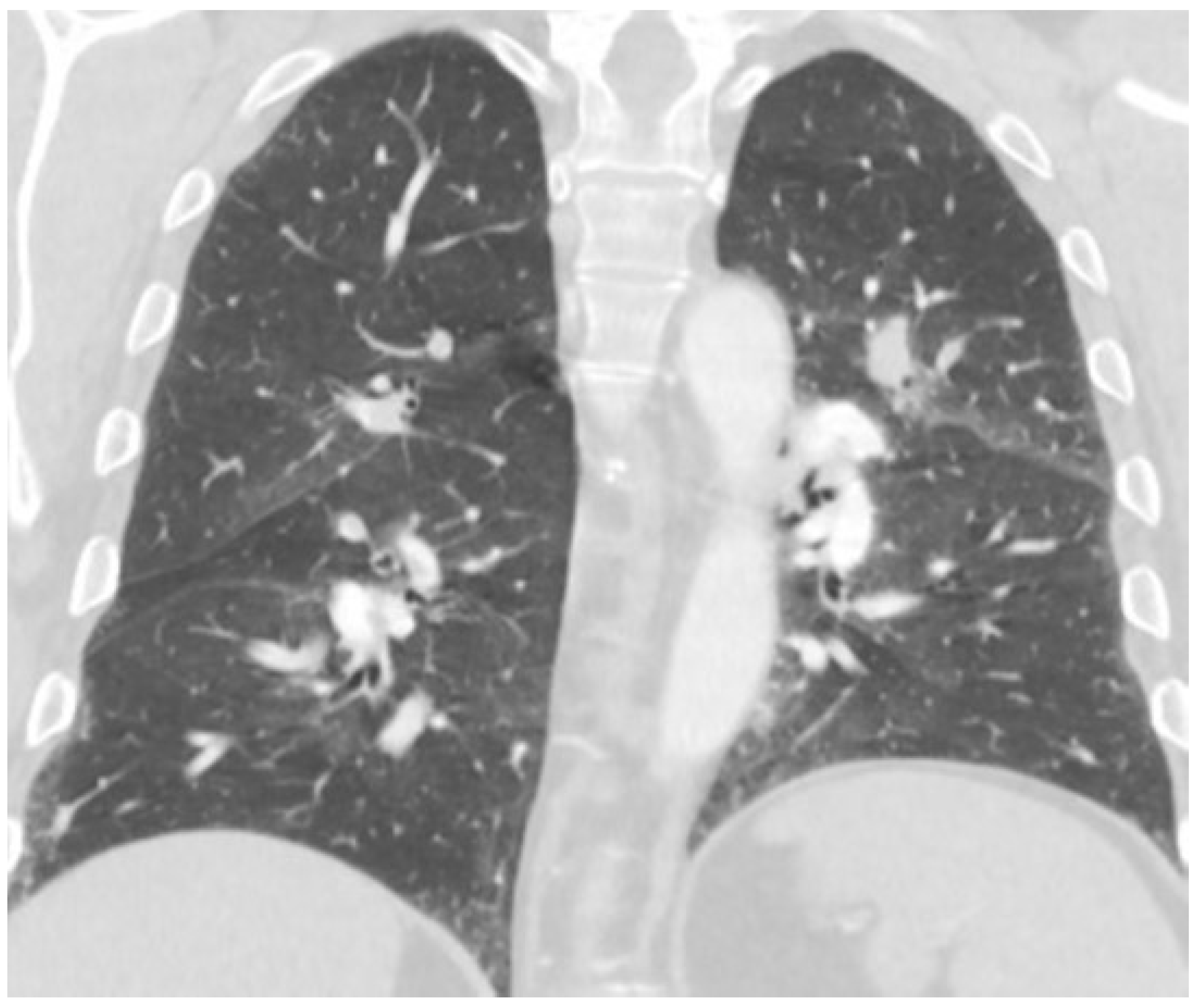 Hematolrep 15 00029 g001 Hematolrep 15 00029 g001