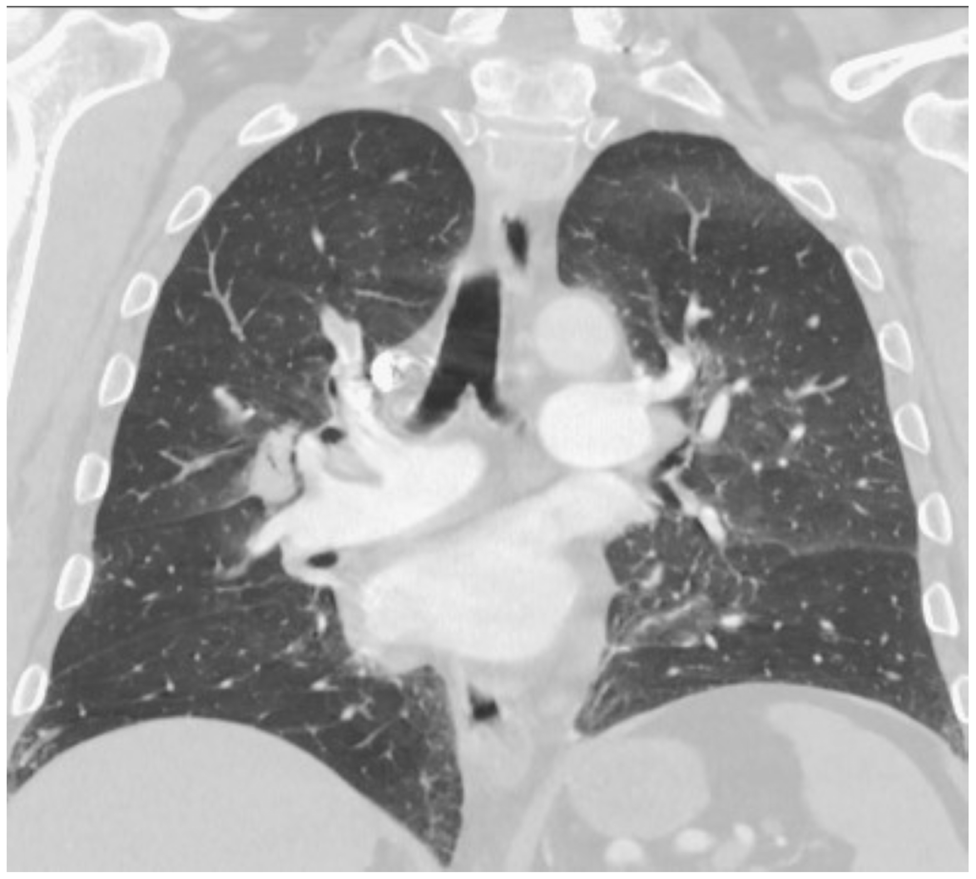 Hematolrep 15 00029 g002 Hematolrep 15 00029 g002