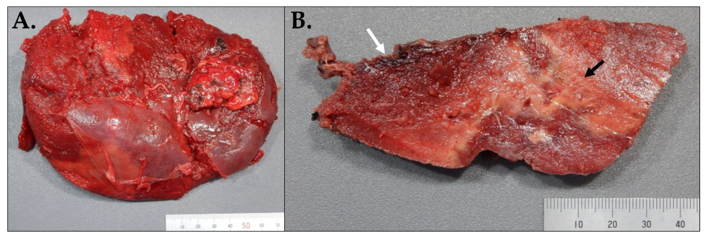 Hematolrep 15 00038 g006 Hematolrep 15 00038 g006