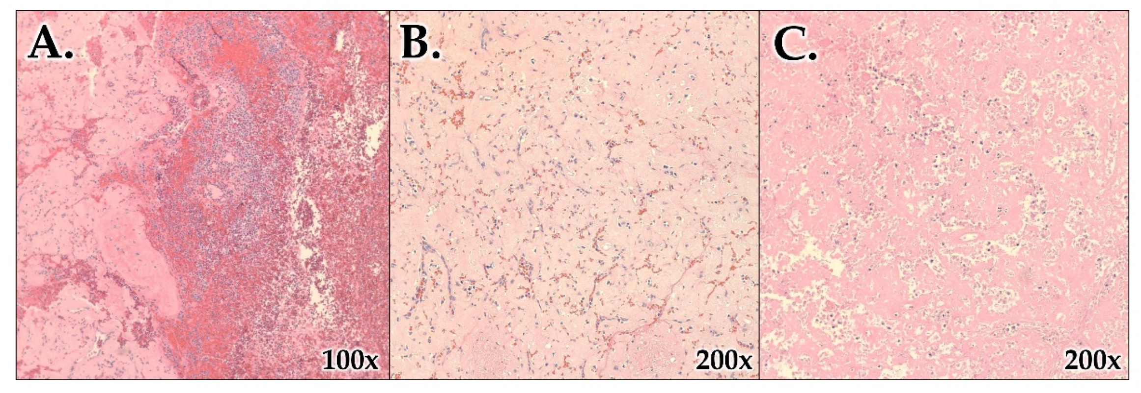 Hematolrep 15 00038 g007 Hematolrep 15 00038 g007