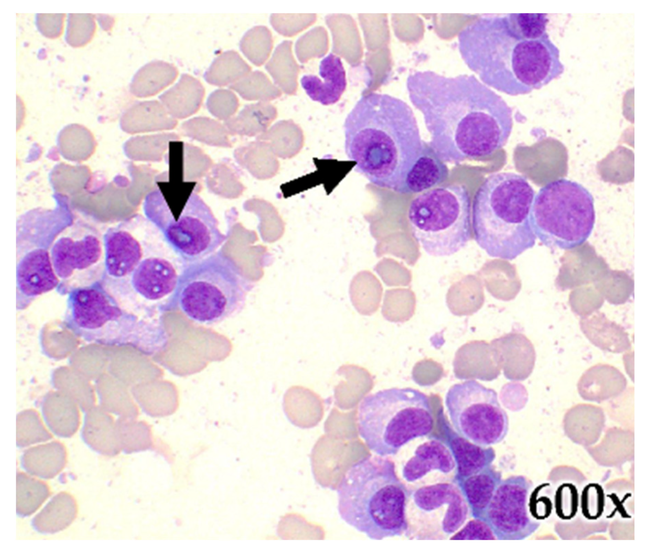 Hematolrep 15 00038 g008 Hematolrep 15 00038 g008