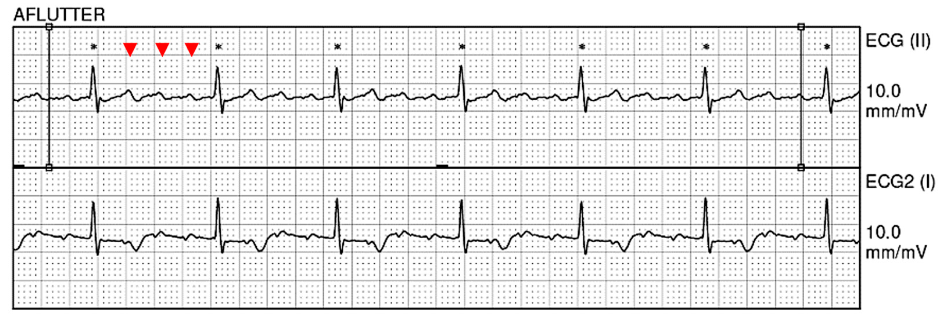 Hematolrep 15 00042 g001 Hematolrep 15 00042 g001