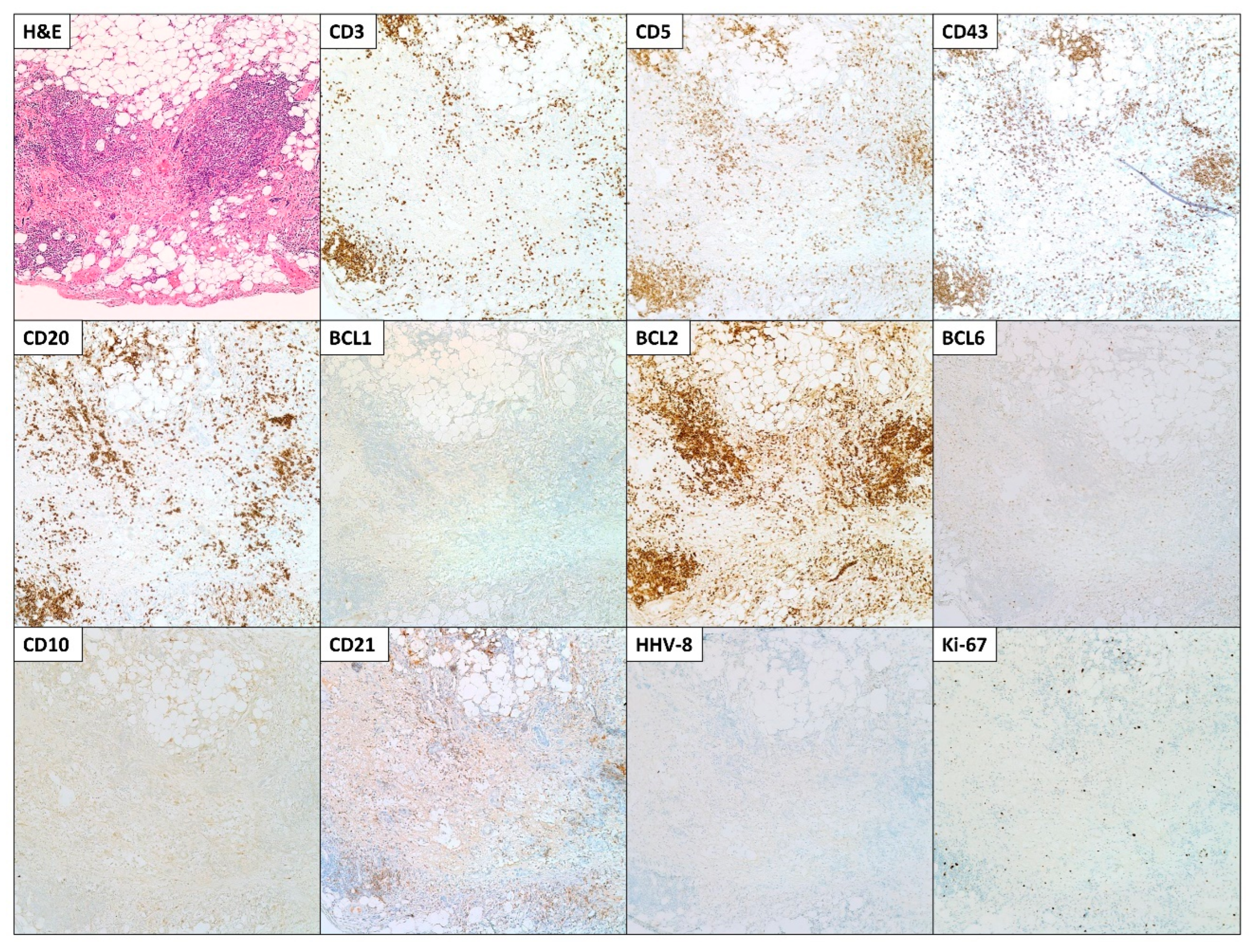 Hematolrep 15 00042 g004 Hematolrep 15 00042 g004