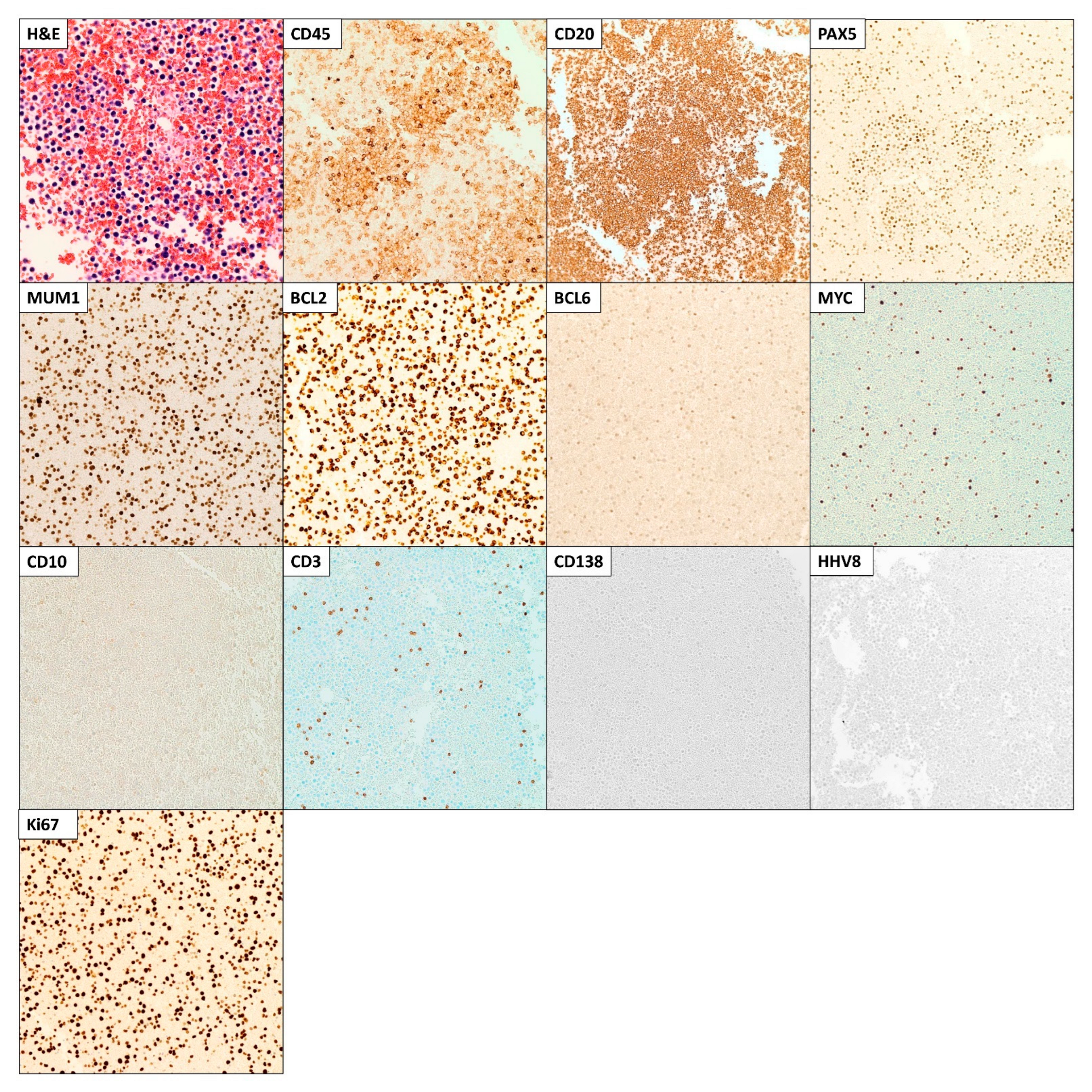 Hematolrep 15 00042 g005 Hematolrep 15 00042 g005