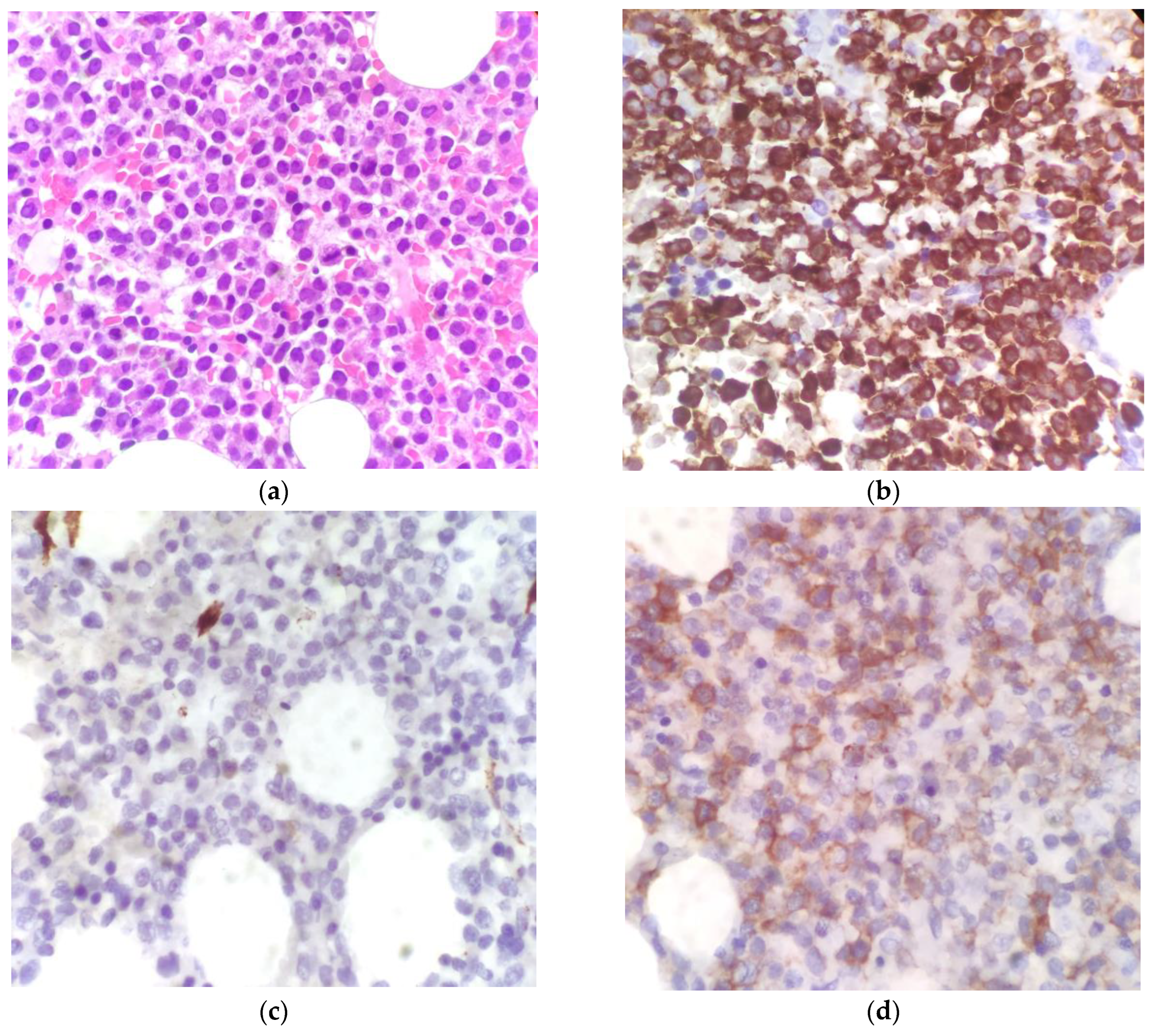 Hematolrep 15 00045 g002
