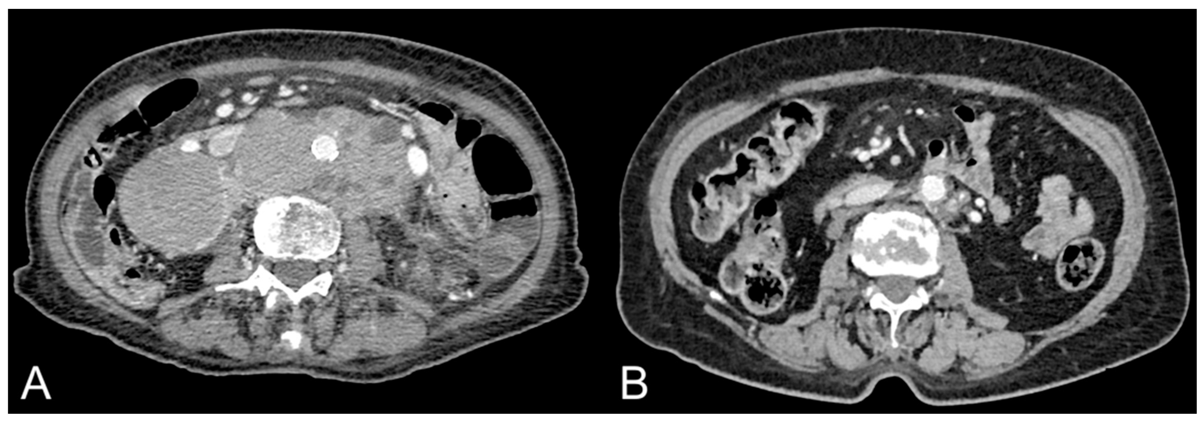 Hematolrep 15 00049 g001 Hematolrep 15 00049 g001