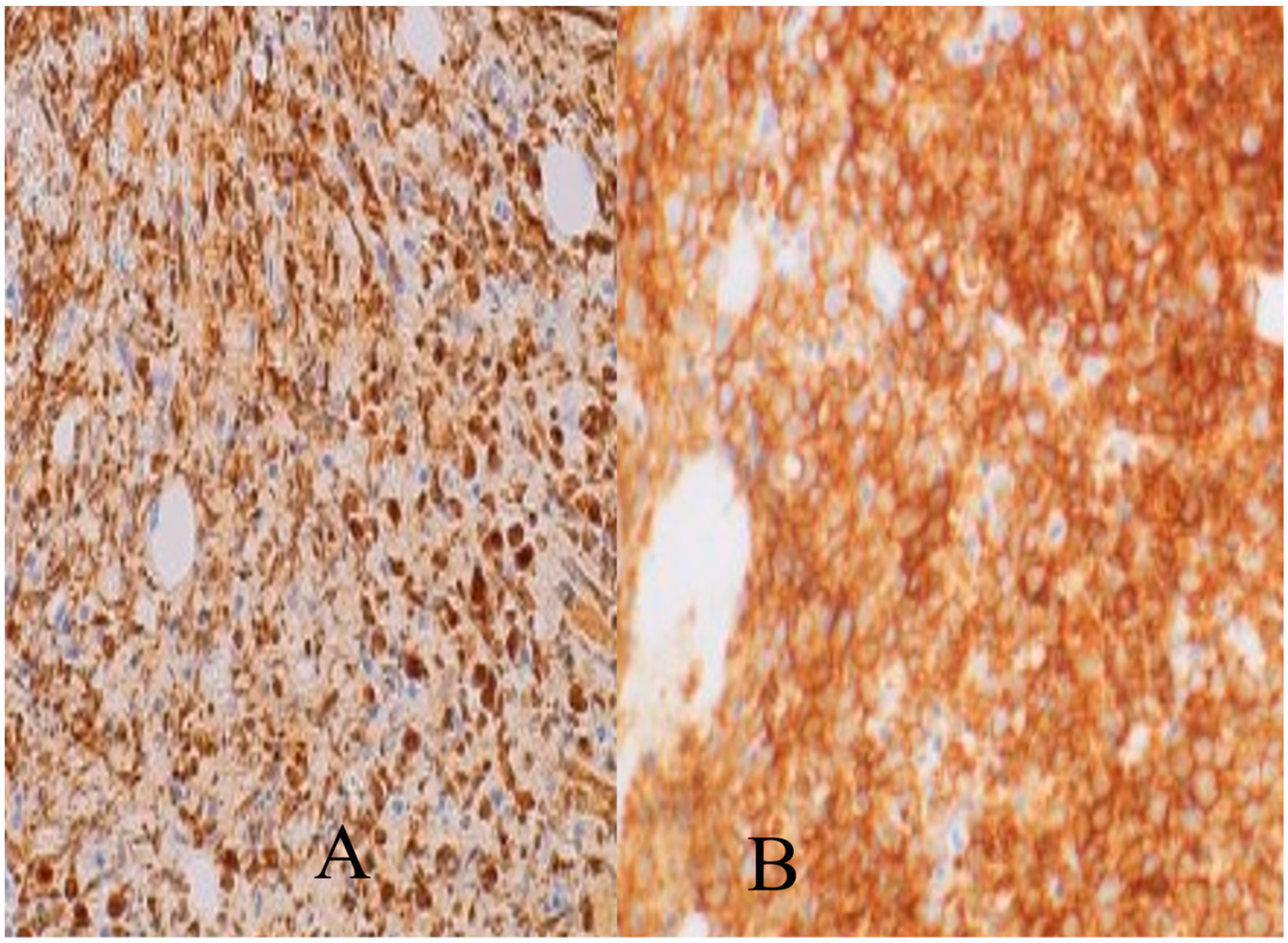 Hematolrep 15 00061 g002