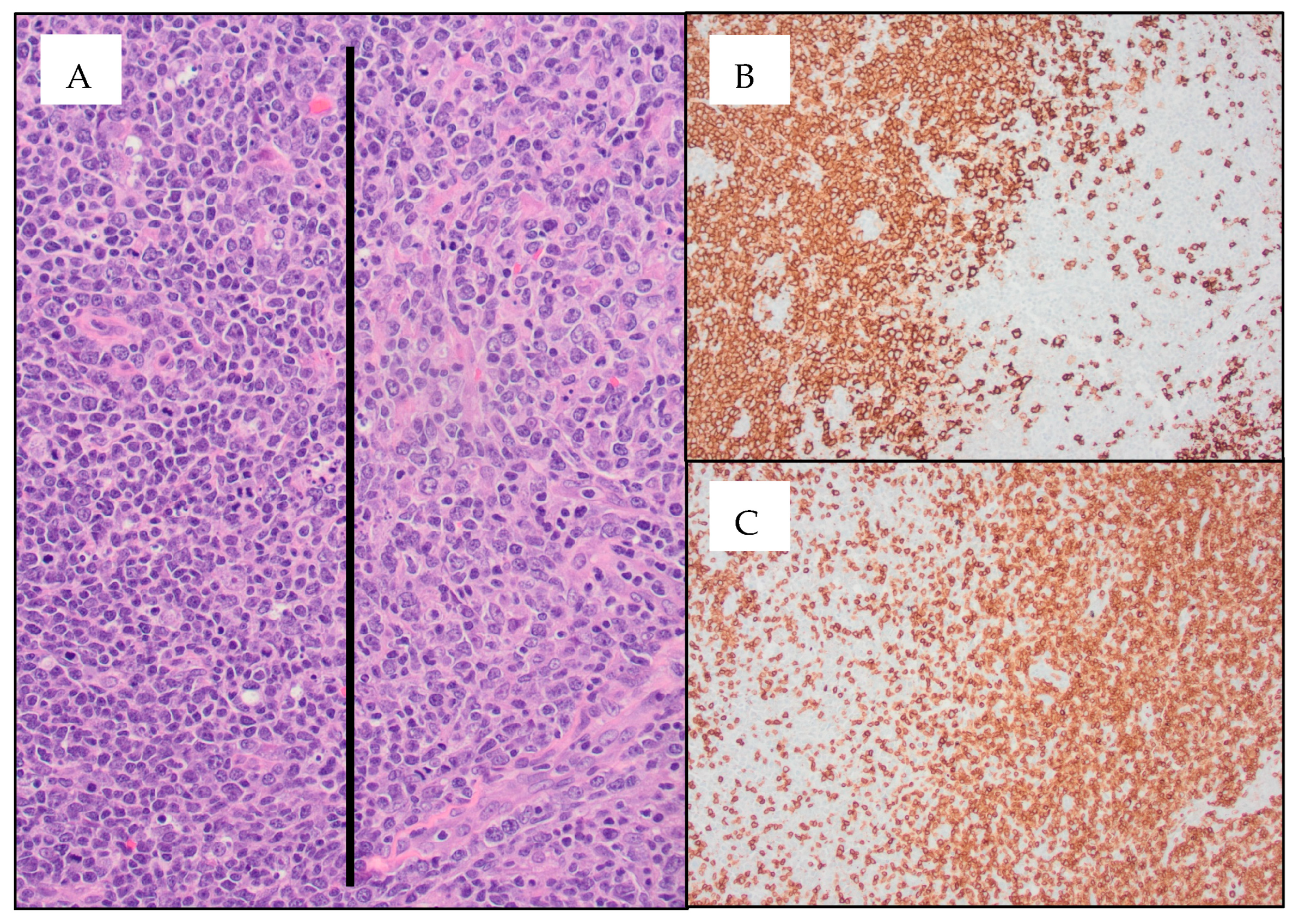 Hematolrep 15 00064 g001