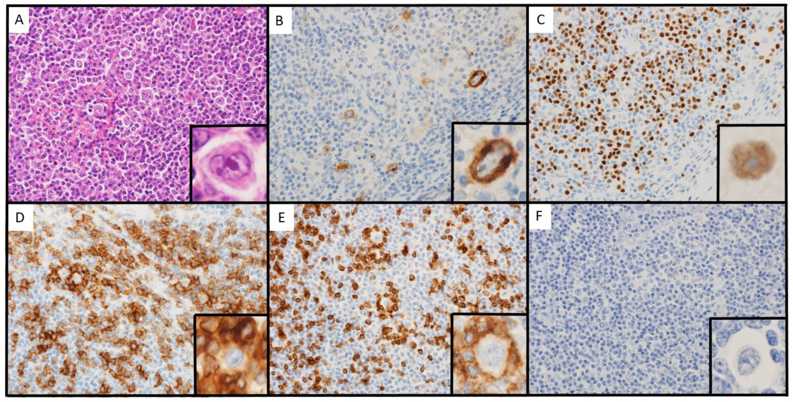Hematolrep 15 00067 g001