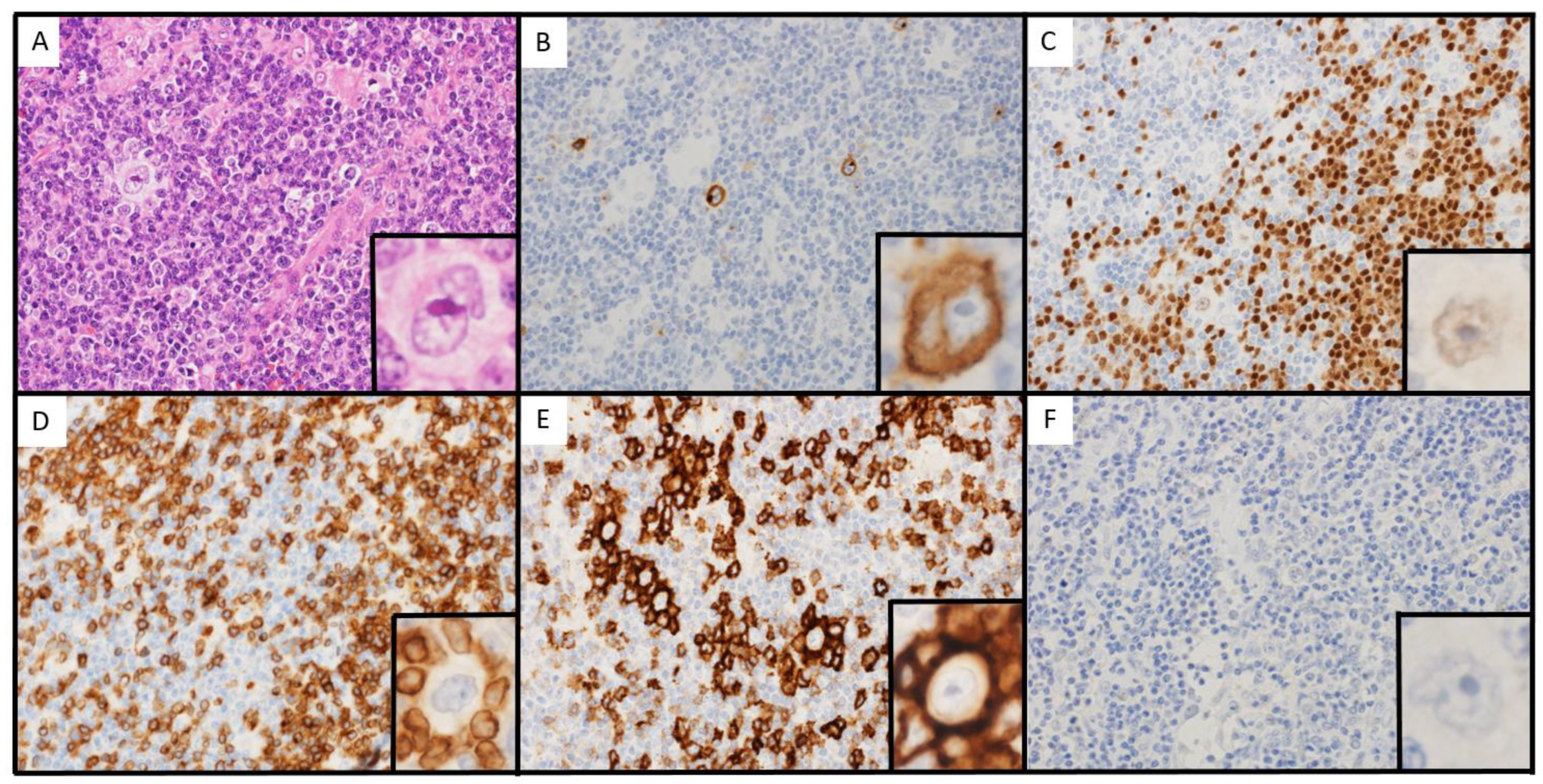 Hematolrep 15 00067 g003