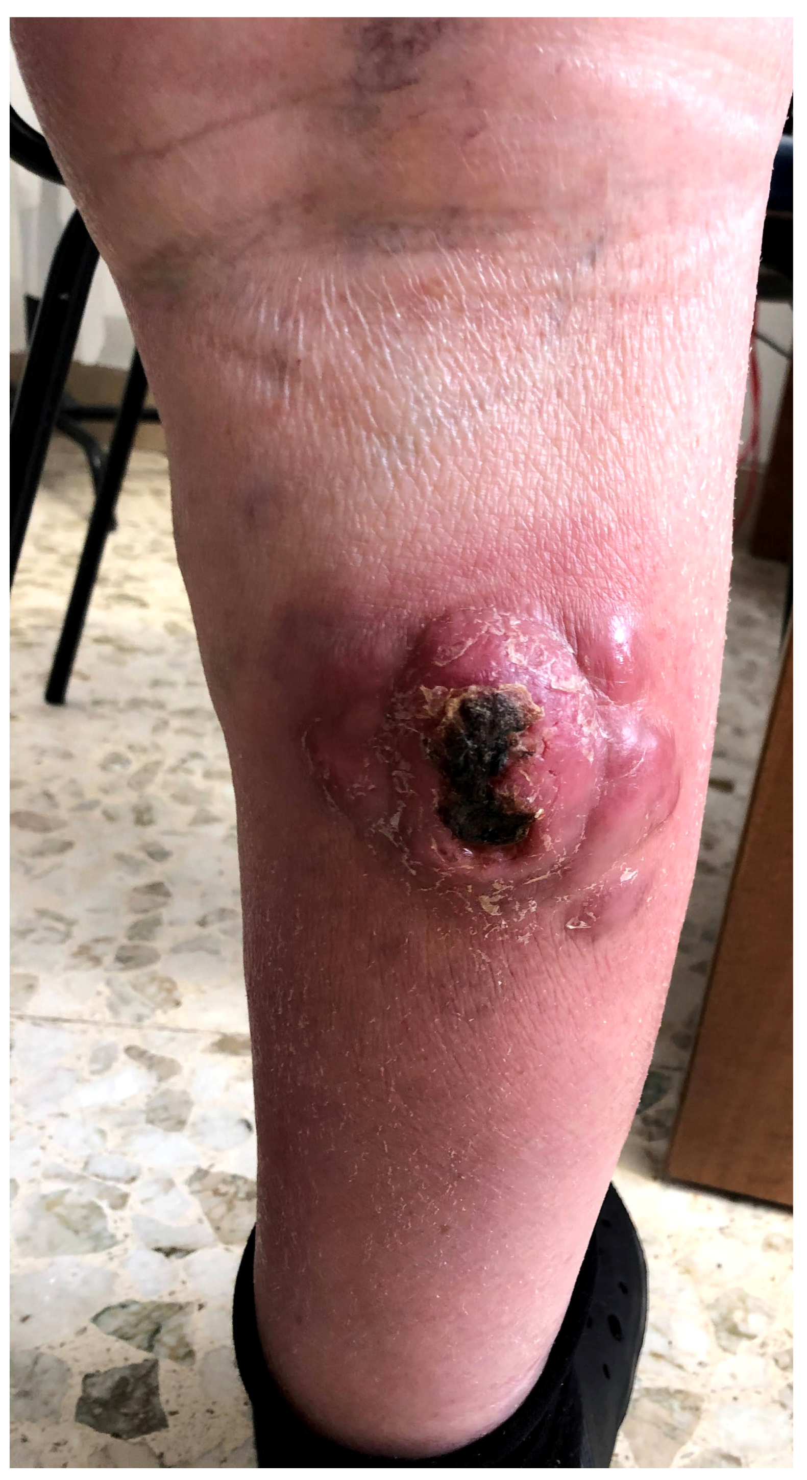 Hematolrep 15 00070 g001