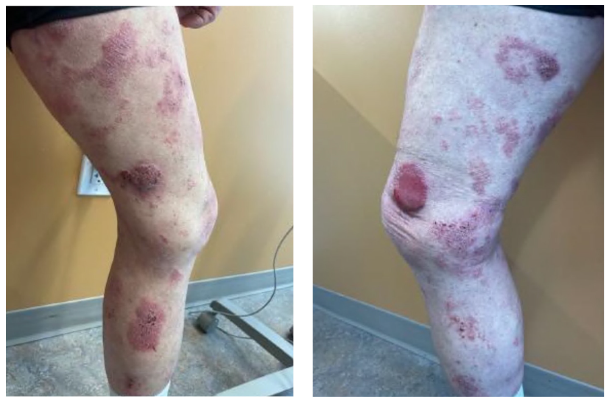 Hematolrep 16 00002 g001 Hematolrep 16 00002 g001