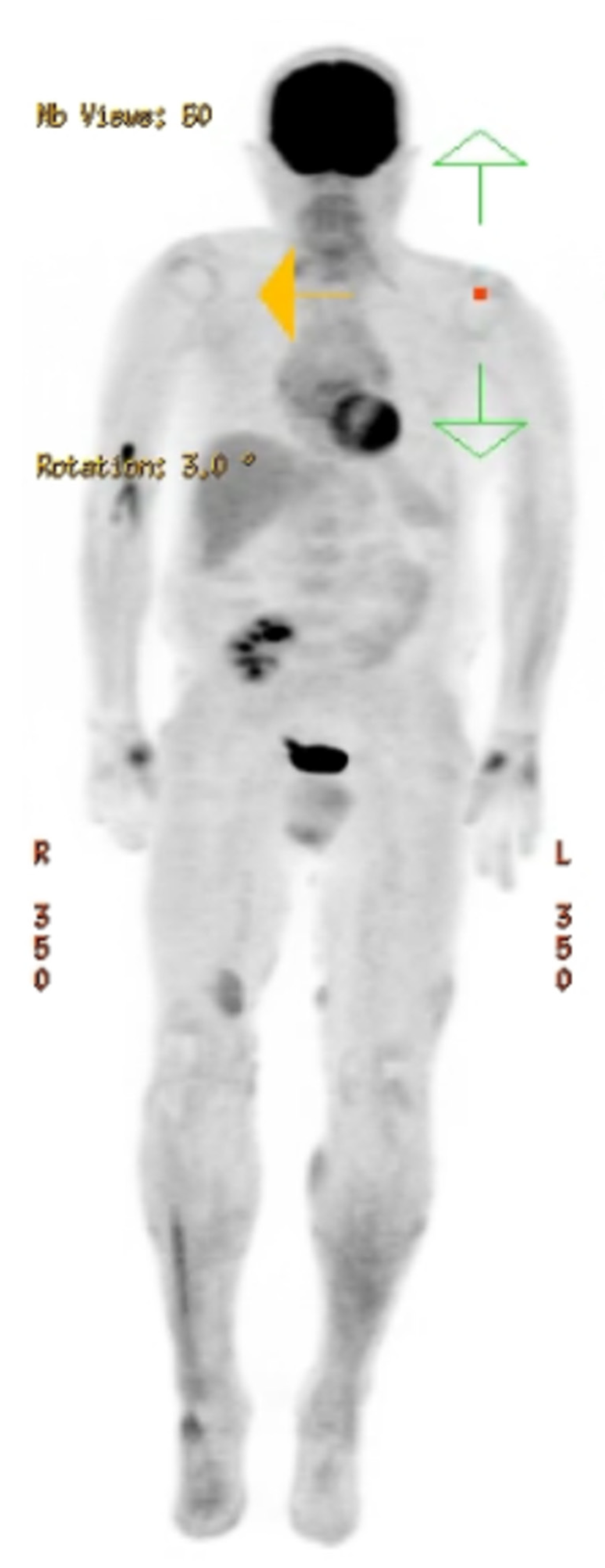 Hematolrep 16 00002 g003 Hematolrep 16 00002 g003