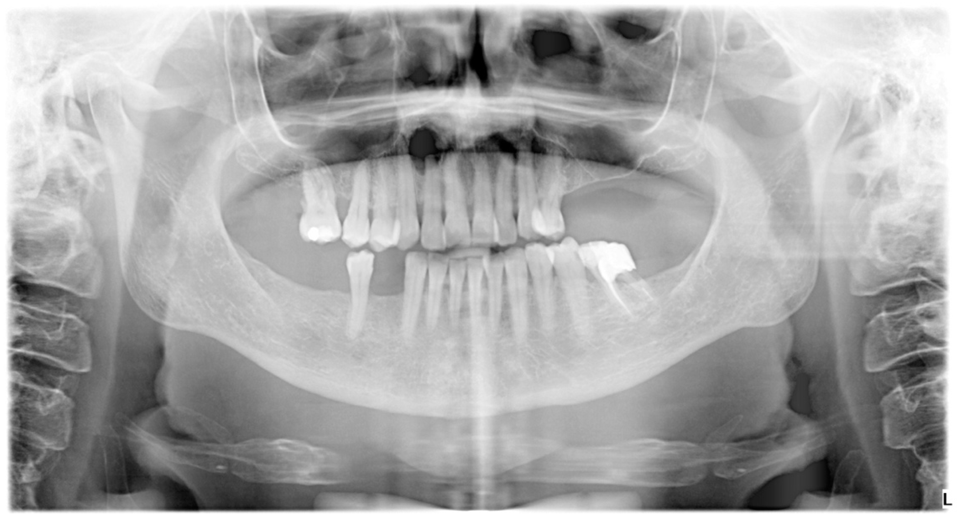 Hematolrep 16 00003 g001