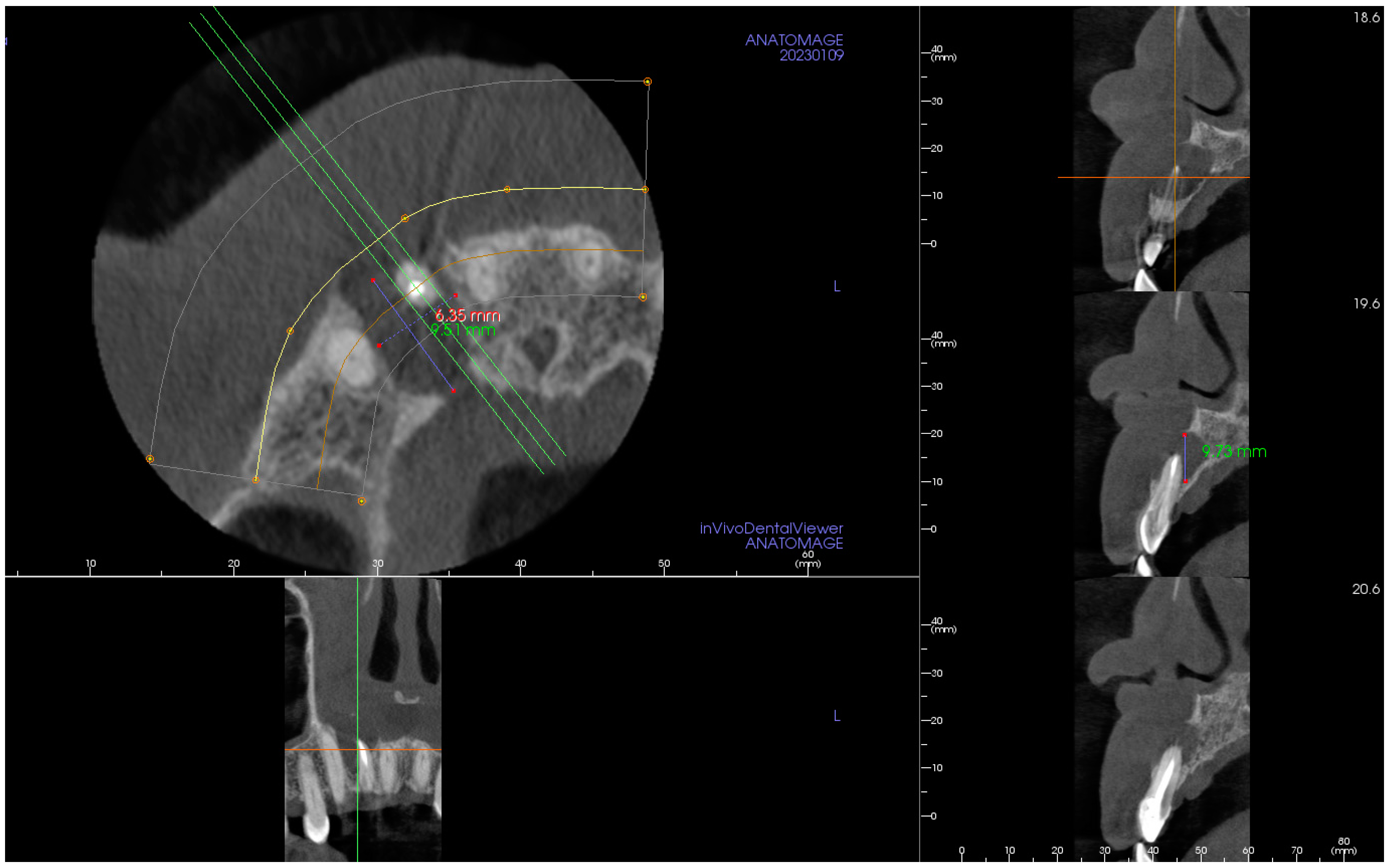 Hematolrep 16 00003 g002