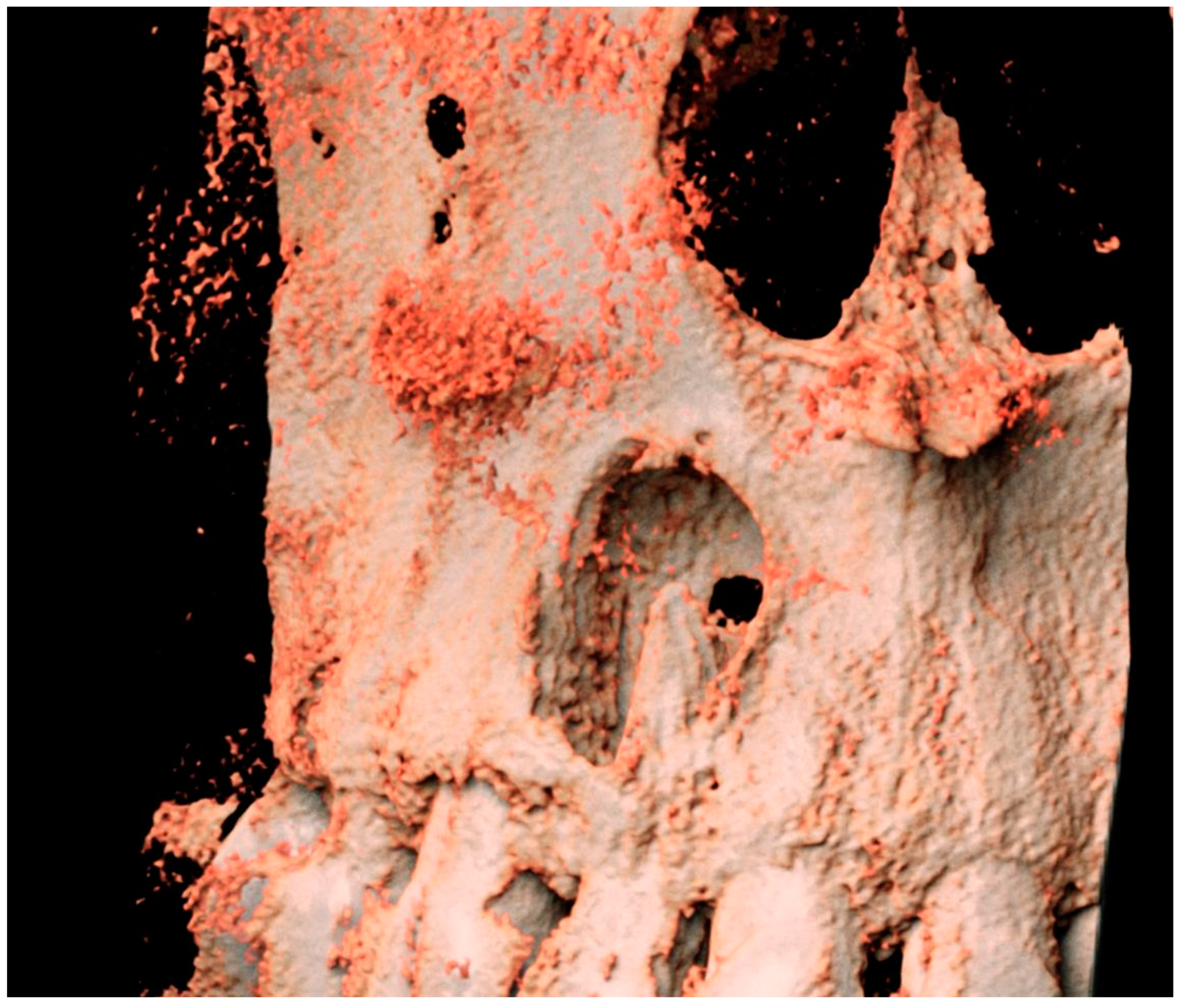 Hematolrep 16 00003 g003