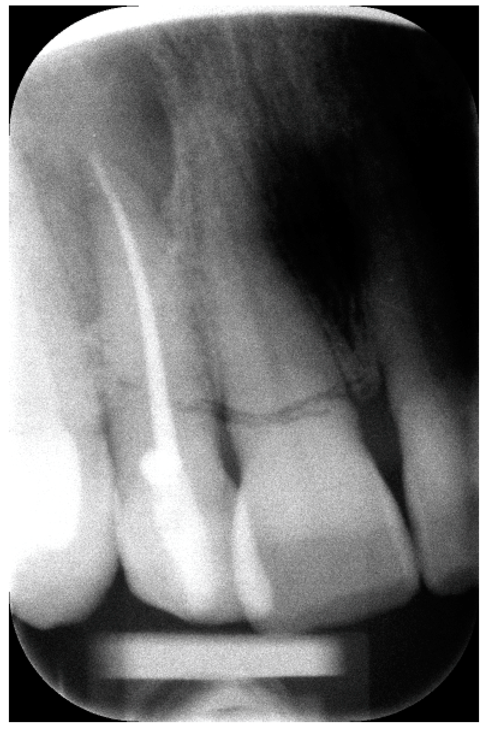 Hematolrep 16 00003 g004