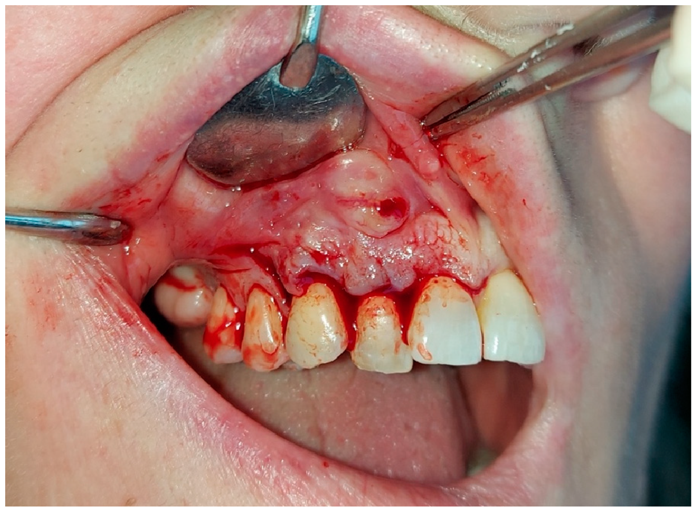 Hematolrep 16 00003 g005