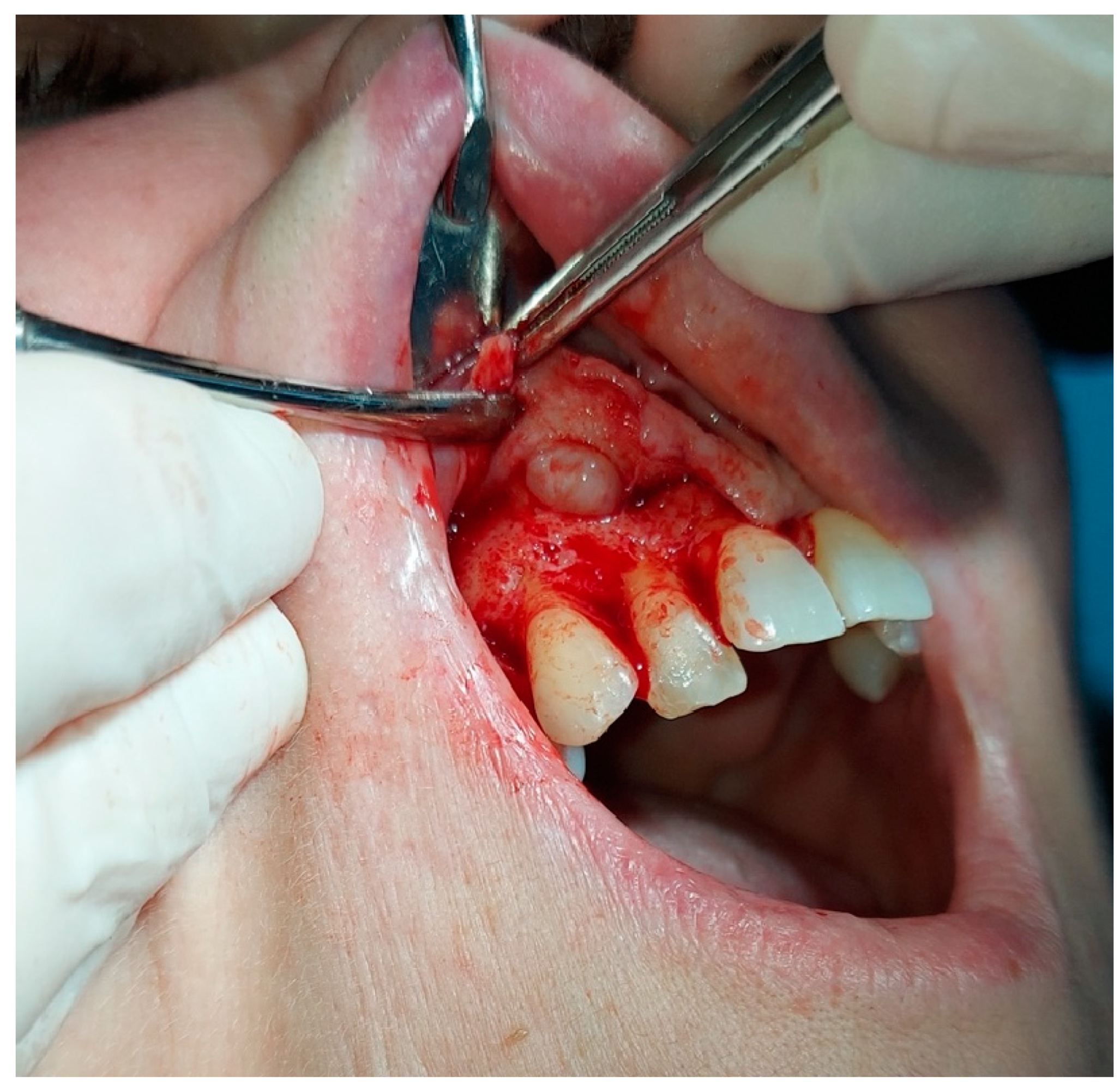 Hematolrep 16 00003 g006