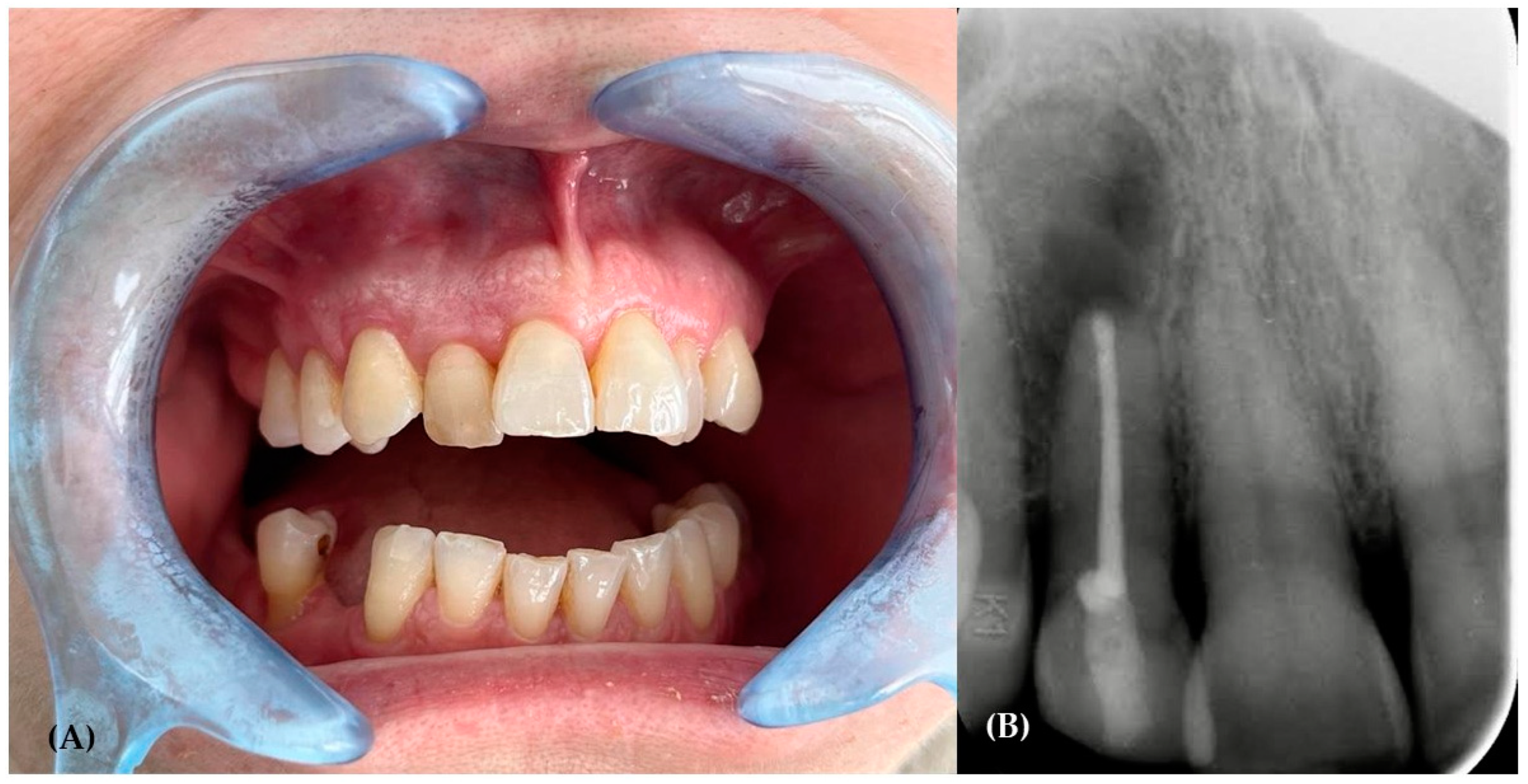 Hematolrep 16 00003 g009