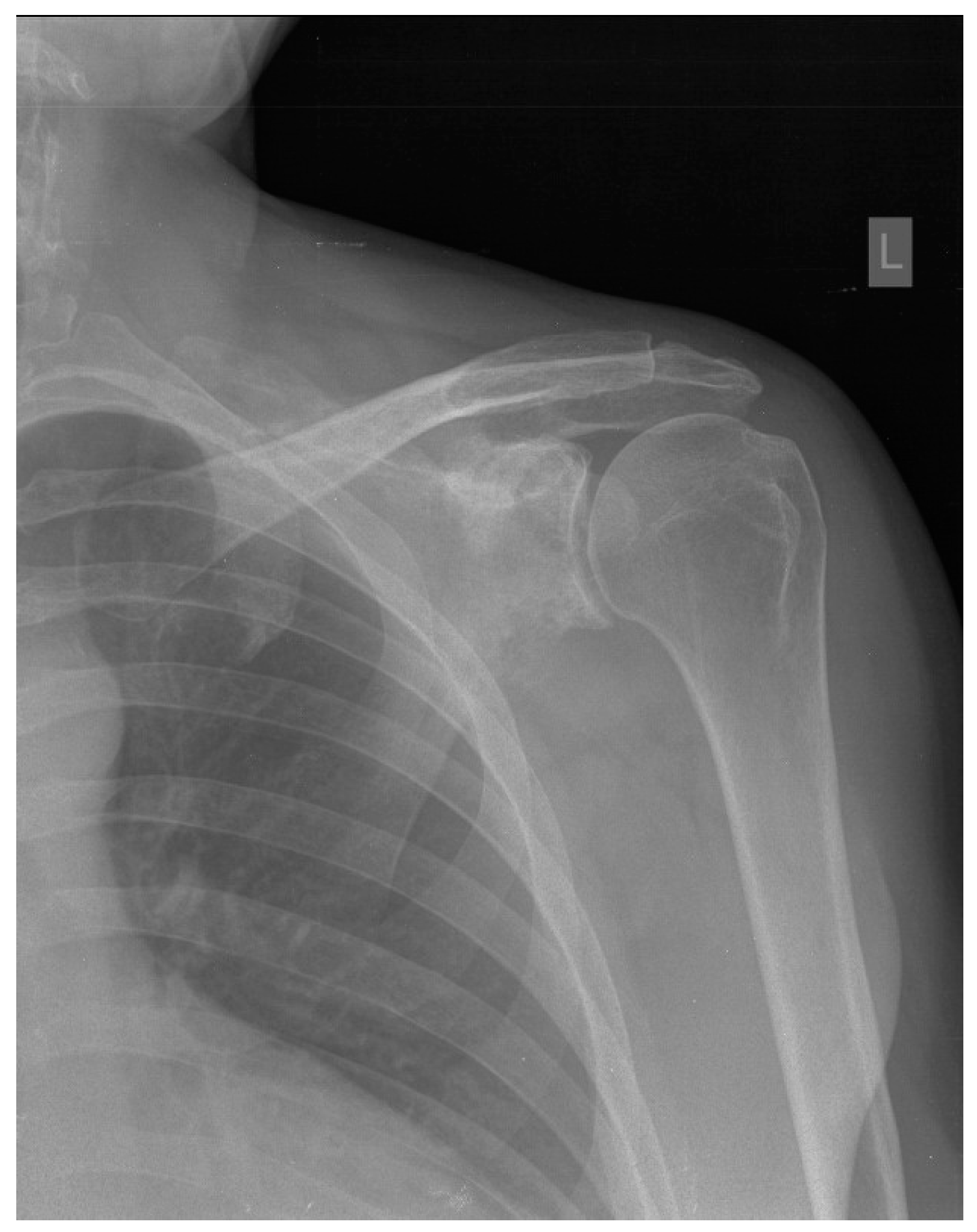 Hematolrep 16 00011 g001