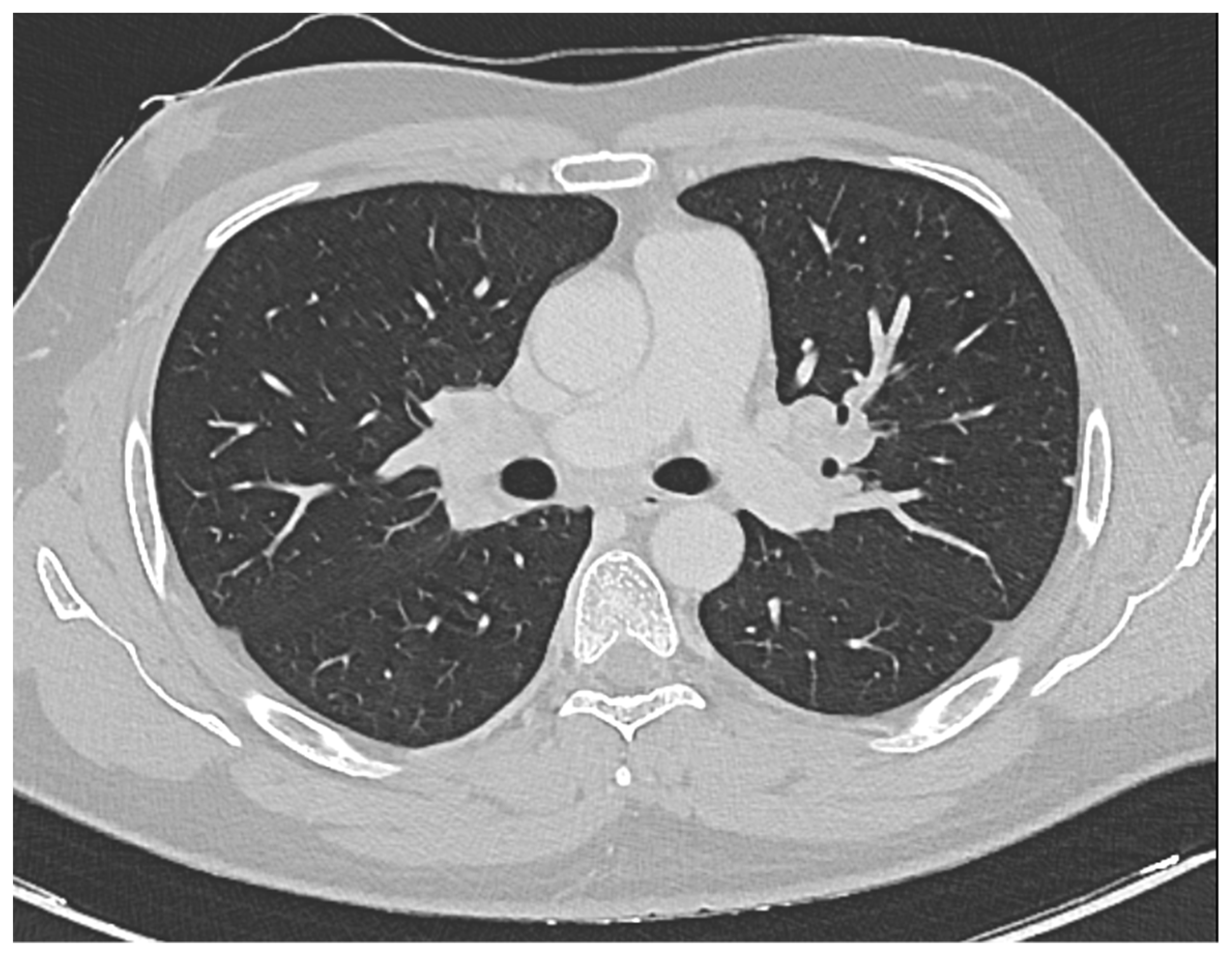 Hematolrep 16 00013 g001